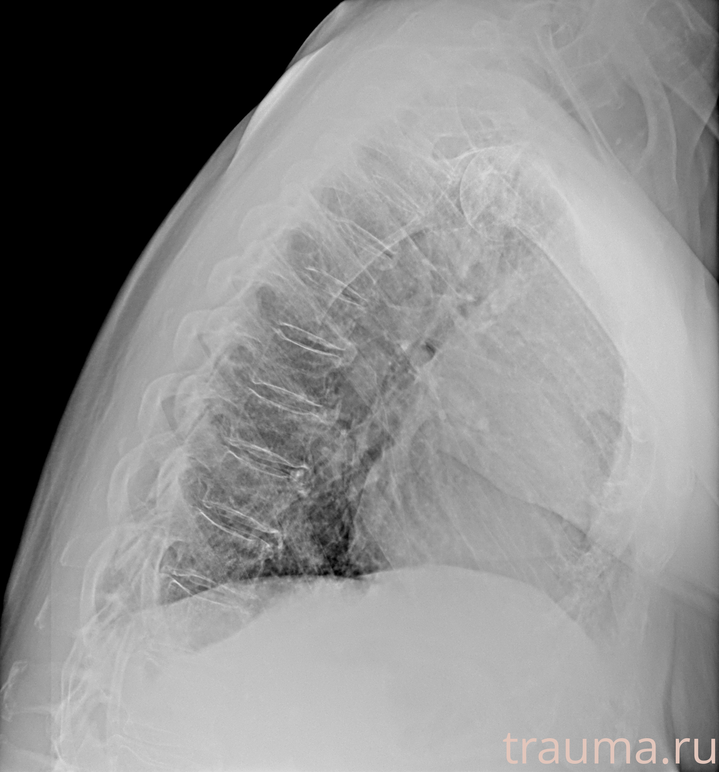 Рентген на дому: по вашему адресу приезжает врач-рентгенолог, травматолог-ортопед с мобильным рентгеновским аппаратом, проводит диагностику травмы или заболевания, делает необходимые рентгенограммы, дает рекомендации по дальнейшему лечению. Получить качественные снимки в домашних условиях возможно благодаря уникальной методике, разработанной МосРентген Центром для института  Склифосовского
