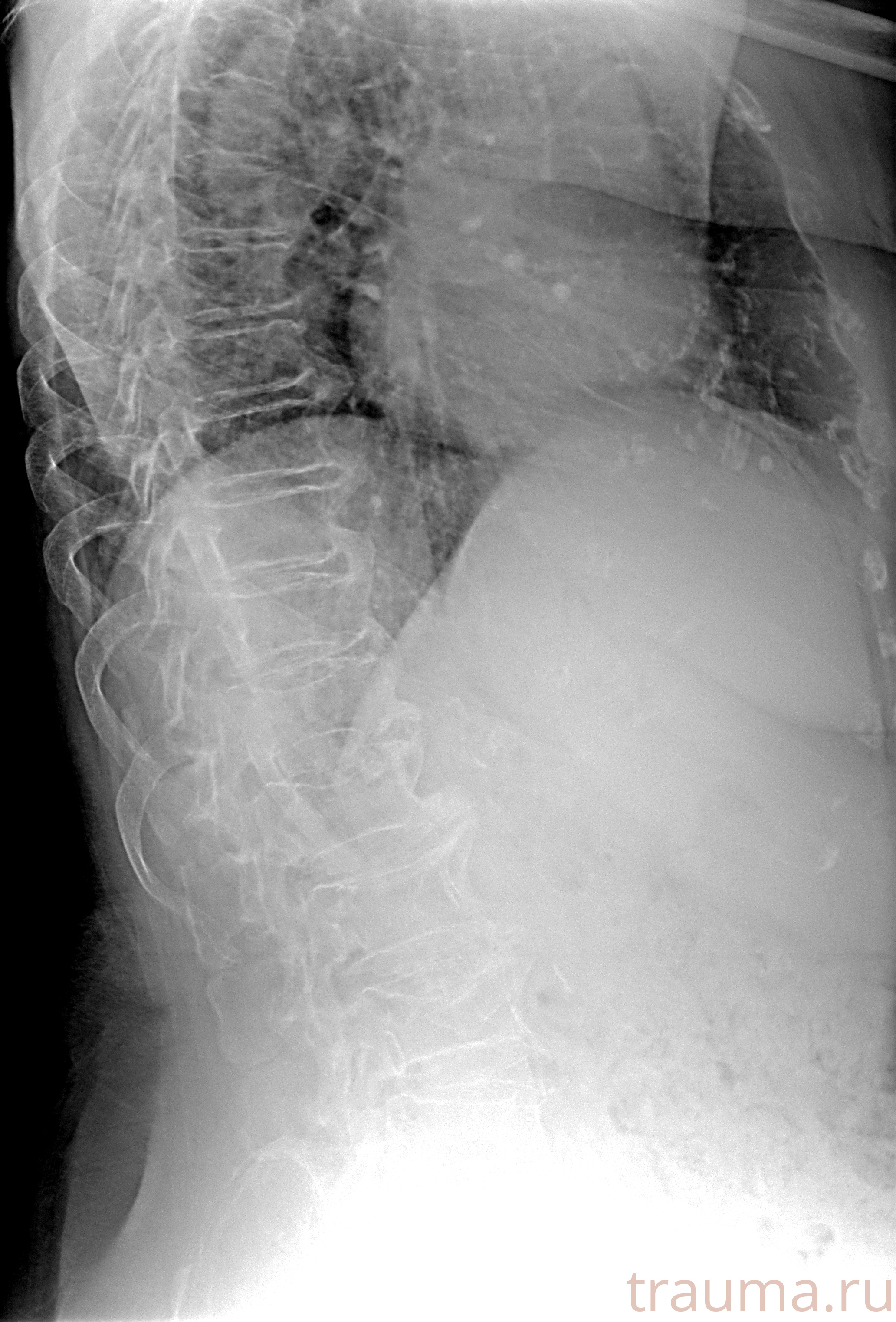 Рентген на дому: по вашему адресу приезжает врач-рентгенолог, травматолог-ортопед с мобильным рентгеновским аппаратом, проводит диагностику травмы или заболевания, делает необходимые рентгенограммы, дает рекомендации по дальнейшему лечению. Получить качественные снимки в домашних условиях возможно благодаря уникальной методике, разработанной МосРентген Центром для института  Склифосовского