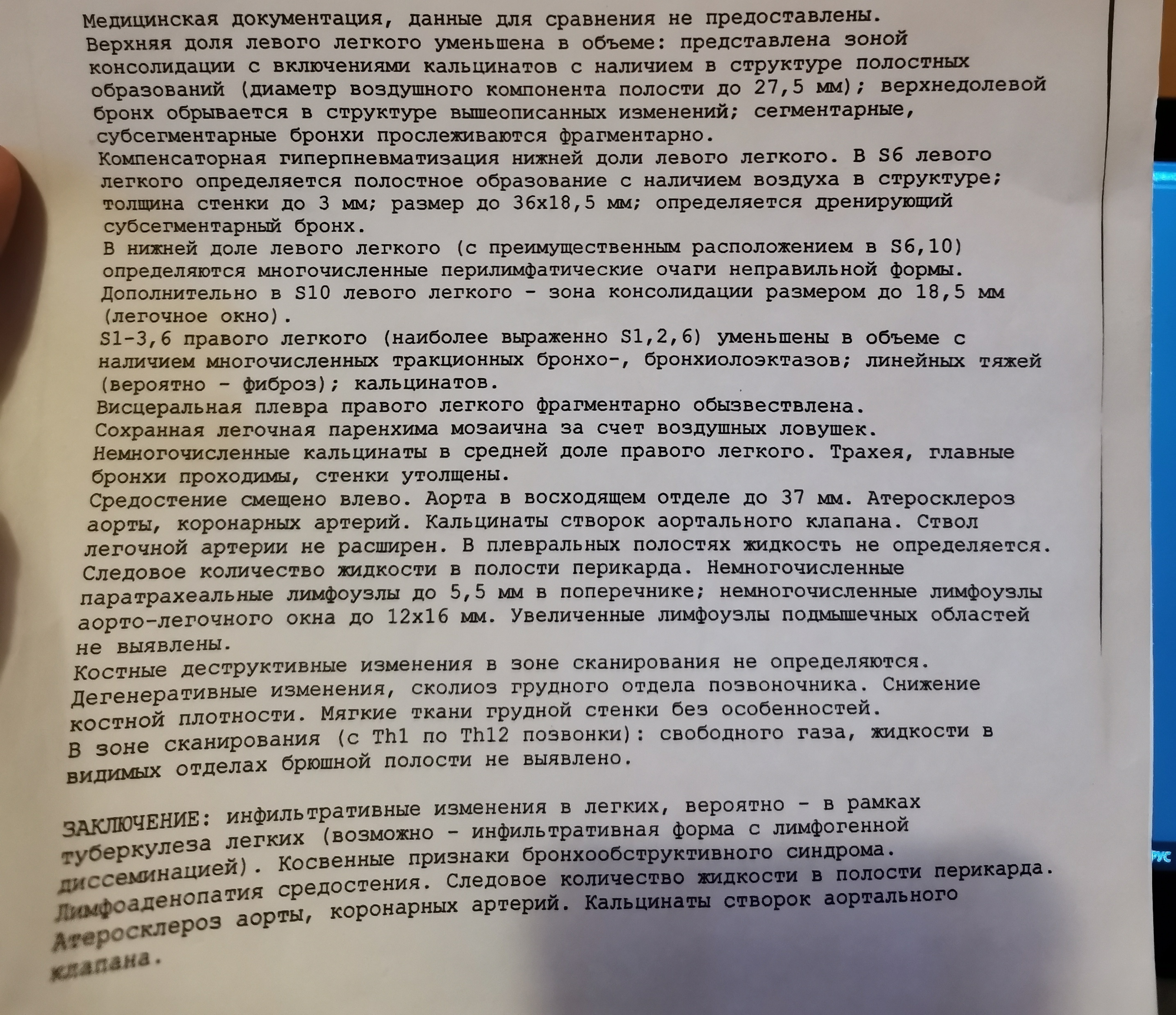 Рентген на дому: по вашему адресу приезжает врач-рентгенолог, травматолог-ортопед с мобильным рентгеновским аппаратом, проводит диагностику травмы или заболевания, делает необходимые рентгенограммы, дает рекомендации по дальнейшему лечению. Получить качественные снимки в домашних условиях возможно благодаря уникальной методике, разработанной МосРентген Центром для института  Склифосовского