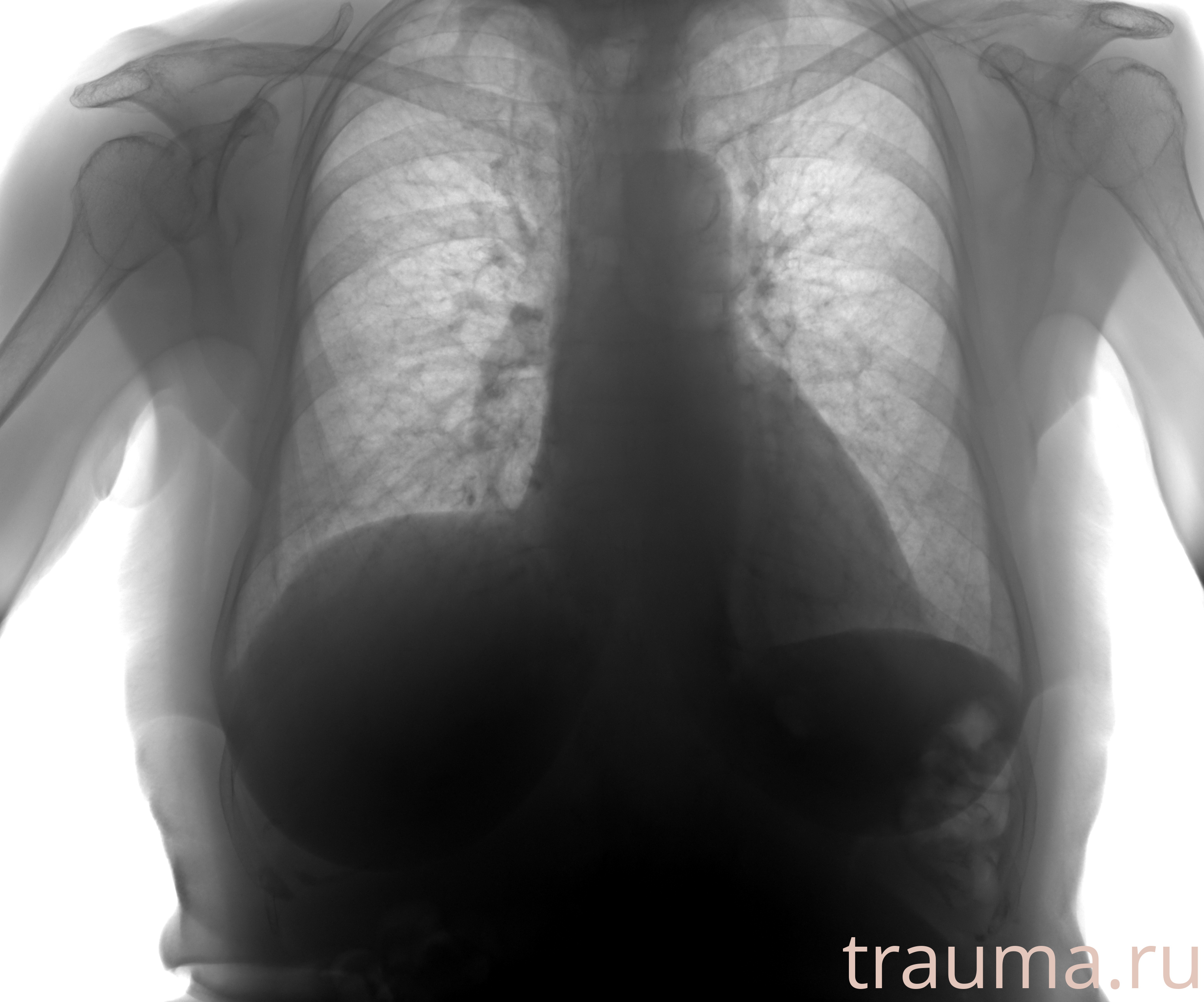 Рентген на дому: по вашему адресу приезжает врач-рентгенолог, травматолог-ортопед с мобильным рентгеновским аппаратом, проводит диагностику травмы или заболевания, делает необходимые рентгенограммы, дает рекомендации по дальнейшему лечению. Получить качественные снимки в домашних условиях возможно благодаря уникальной методике, разработанной МосРентген Центром для института  Склифосовского