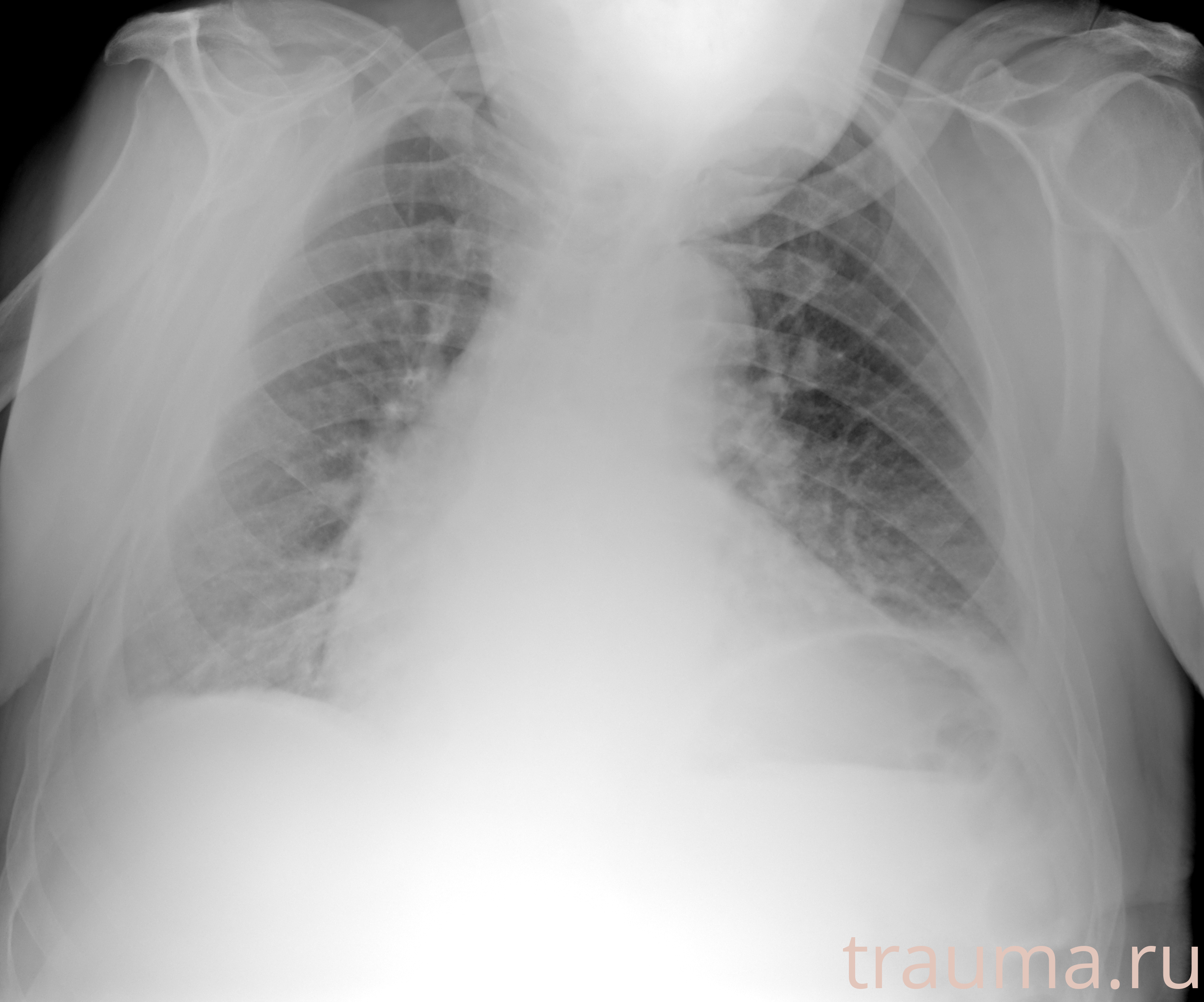 Рентген на дому: по вашему адресу приезжает врач-рентгенолог, травматолог-ортопед с мобильным рентгеновским аппаратом, проводит диагностику травмы или заболевания, делает необходимые рентгенограммы, дает рекомендации по дальнейшему лечению. Получить качественные снимки в домашних условиях возможно благодаря уникальной методике, разработанной МосРентген Центром для института  Склифосовского