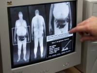 Пределы изменения условий рентгенографии