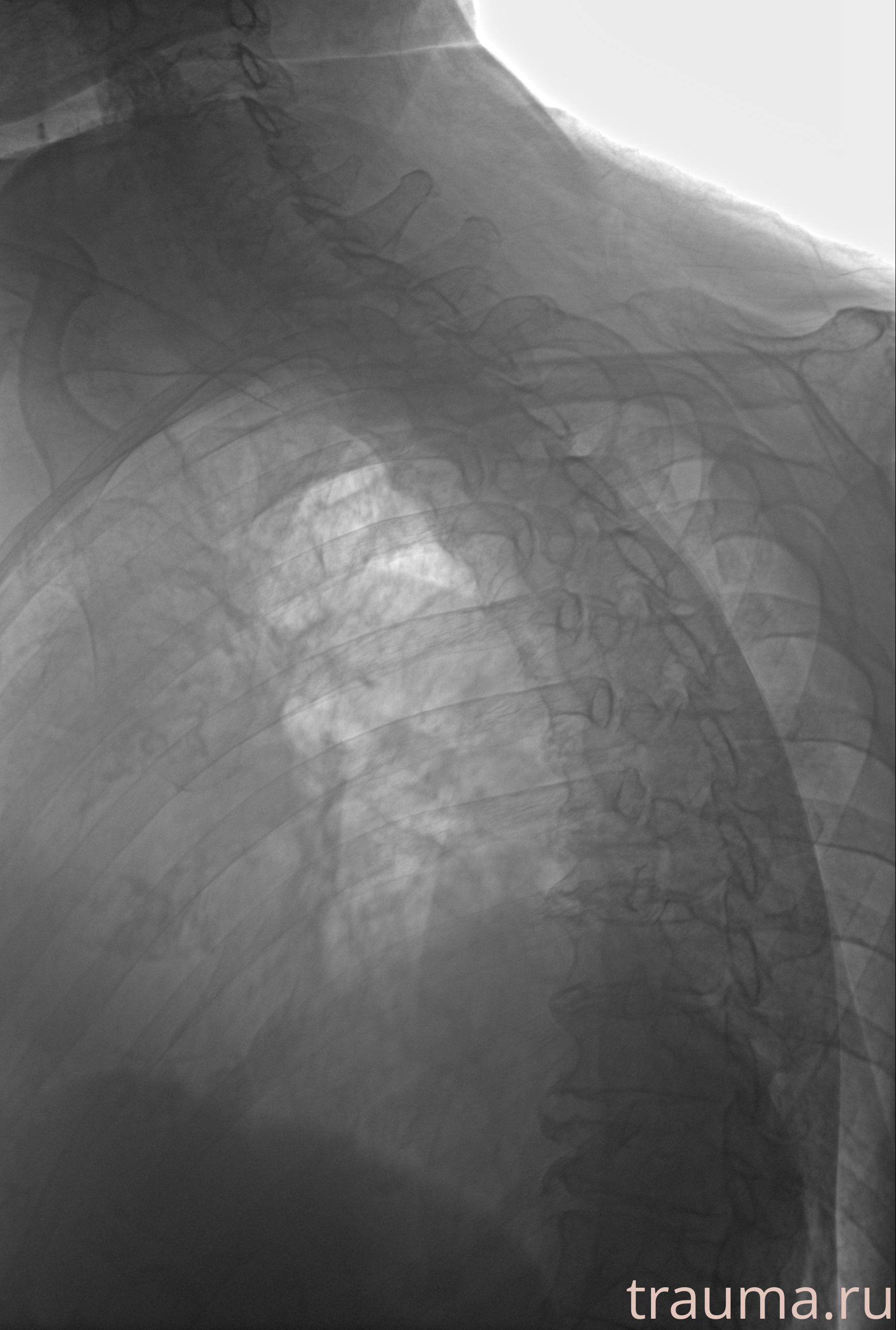 Рентген на дому: по вашему адресу приезжает врач-рентгенолог, травматолог-ортопед с мобильным рентгеновским аппаратом, проводит диагностику травмы или заболевания, делает необходимые рентгенограммы, дает рекомендации по дальнейшему лечению. Получить качественные снимки в домашних условиях возможно благодаря уникальной методике, разработанной МосРентген Центром для института  Склифосовского
