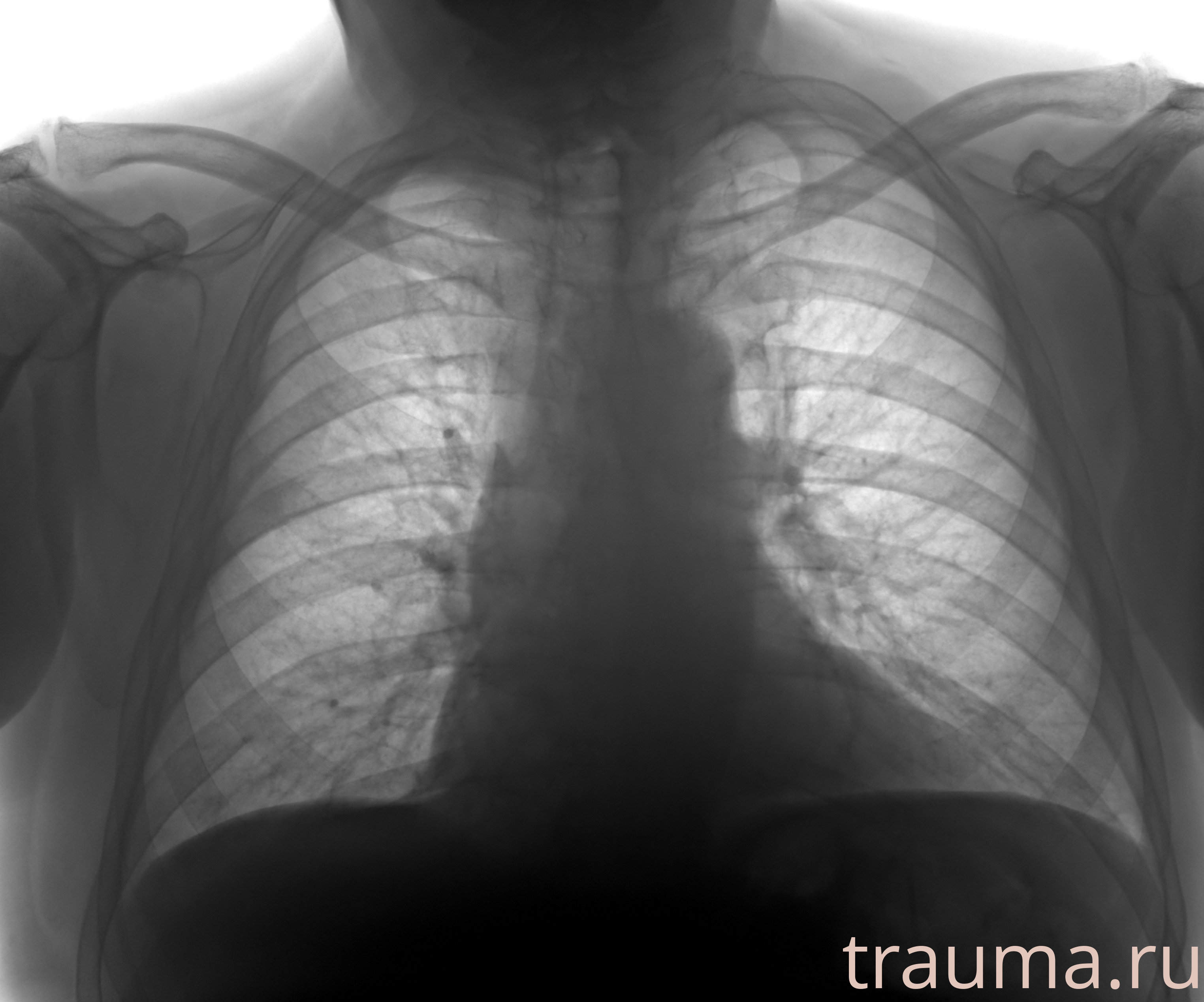 Рентген на дому: по вашему адресу приезжает врач-рентгенолог, травматолог-ортопед с мобильным рентгеновским аппаратом, проводит диагностику травмы или заболевания, делает необходимые рентгенограммы, дает рекомендации по дальнейшему лечению. Получить качественные снимки в домашних условиях возможно благодаря уникальной методике, разработанной МосРентген Центром для института  Склифосовского