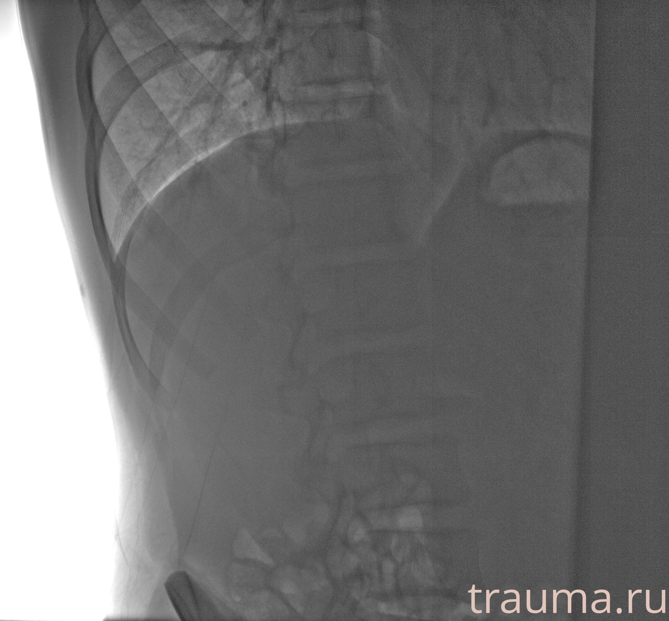 Рентген на дому: по вашему адресу приезжает врач-рентгенолог, травматолог-ортопед с мобильным рентгеновским аппаратом, проводит диагностику травмы или заболевания, делает необходимые рентгенограммы, дает рекомендации по дальнейшему лечению. Получить качественные снимки в домашних условиях возможно благодаря уникальной методике, разработанной МосРентген Центром для института  Склифосовского