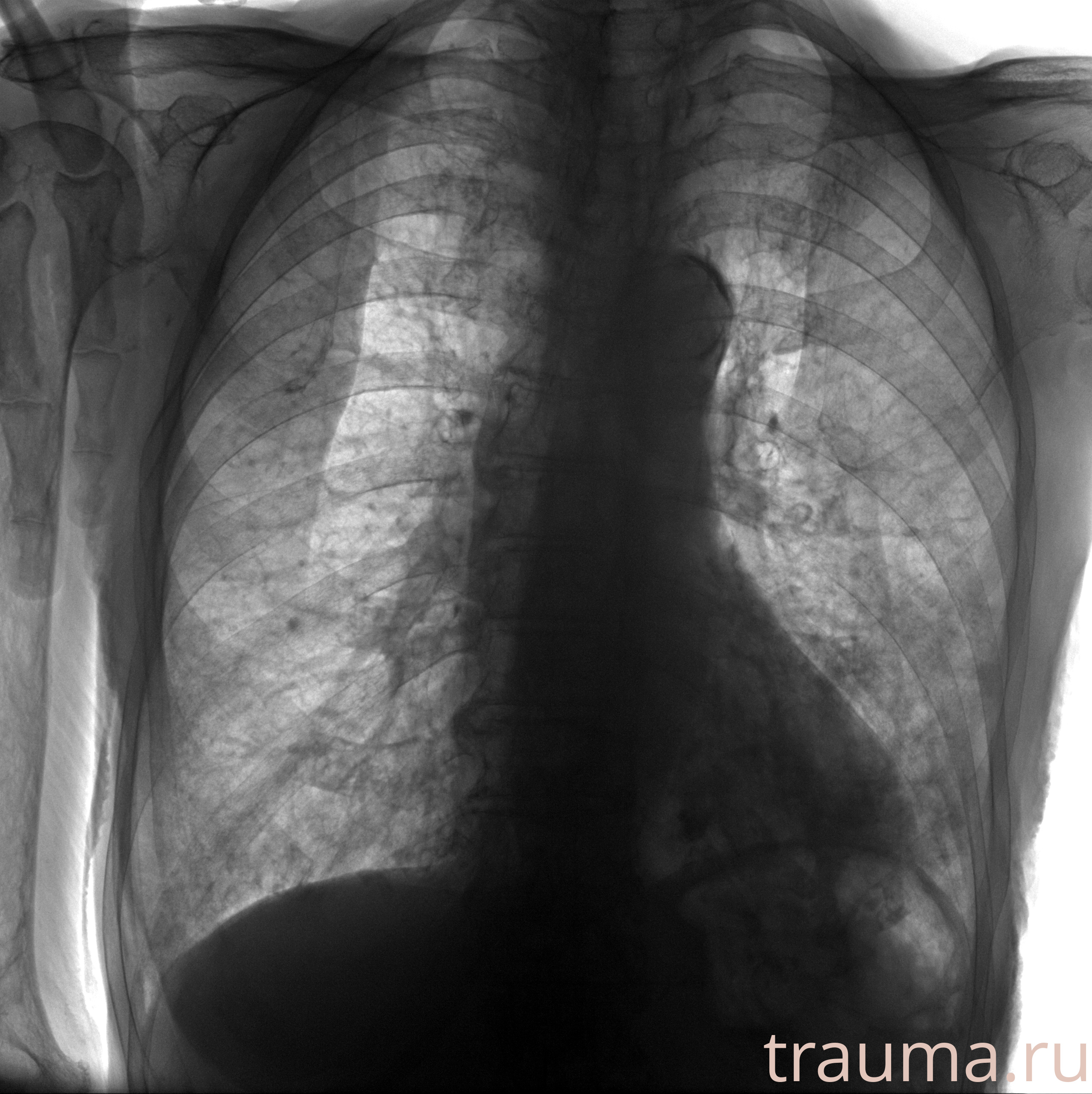 Рентген на дому: по вашему адресу приезжает врач-рентгенолог, травматолог-ортопед с мобильным рентгеновским аппаратом, проводит диагностику травмы или заболевания, делает необходимые рентгенограммы, дает рекомендации по дальнейшему лечению. Получить качественные снимки в домашних условиях возможно благодаря уникальной методике, разработанной МосРентген Центром для института  Склифосовского