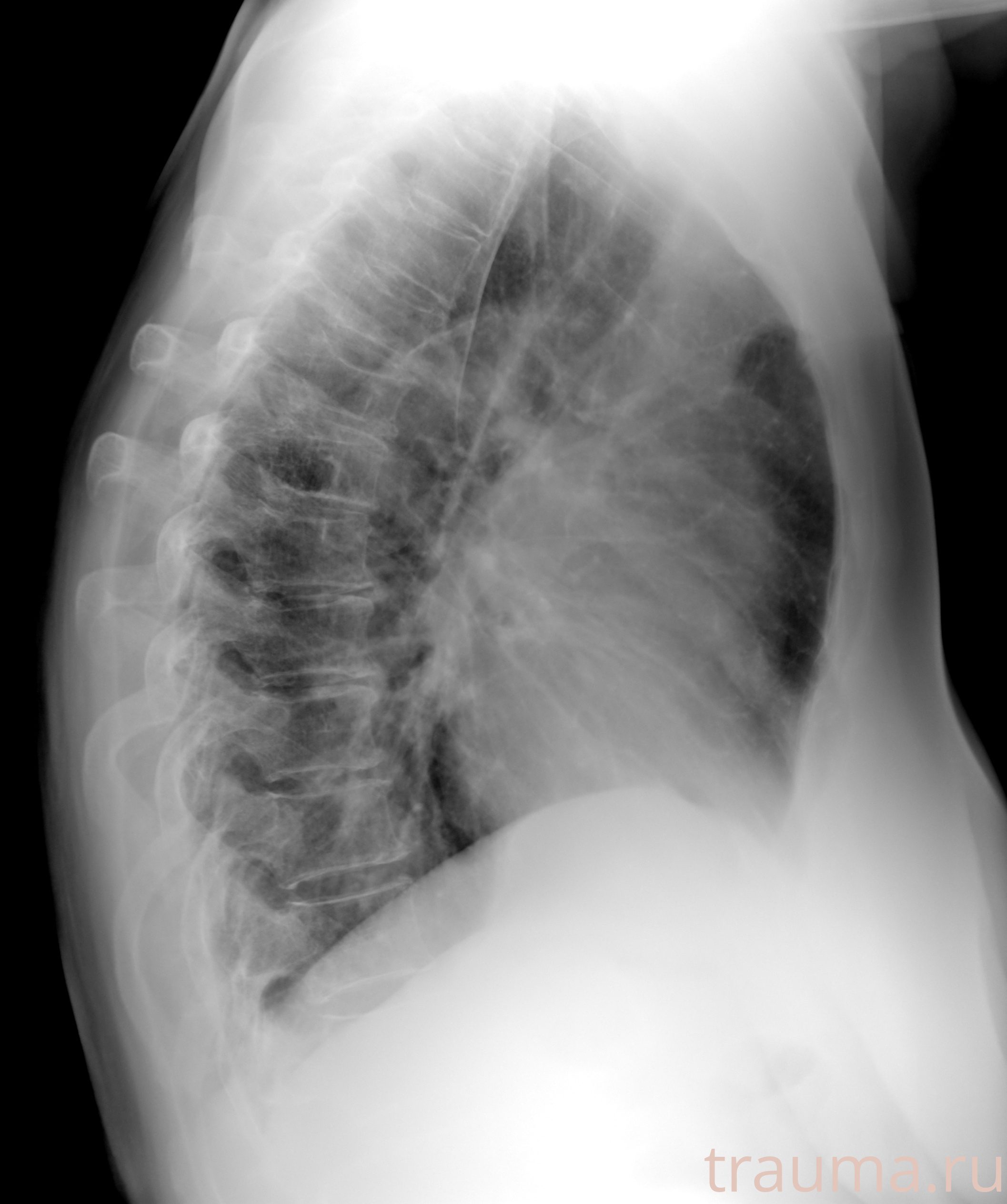 Рентген на дому: по вашему адресу приезжает врач-рентгенолог, травматолог-ортопед с мобильным рентгеновским аппаратом, проводит диагностику травмы или заболевания, делает необходимые рентгенограммы, дает рекомендации по дальнейшему лечению. Получить качественные снимки в домашних условиях возможно благодаря уникальной методике, разработанной МосРентген Центром для института  Склифосовского