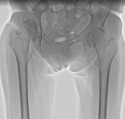 Еще 3 новых аппарата для диагностики заработали в больницах Подмосковья