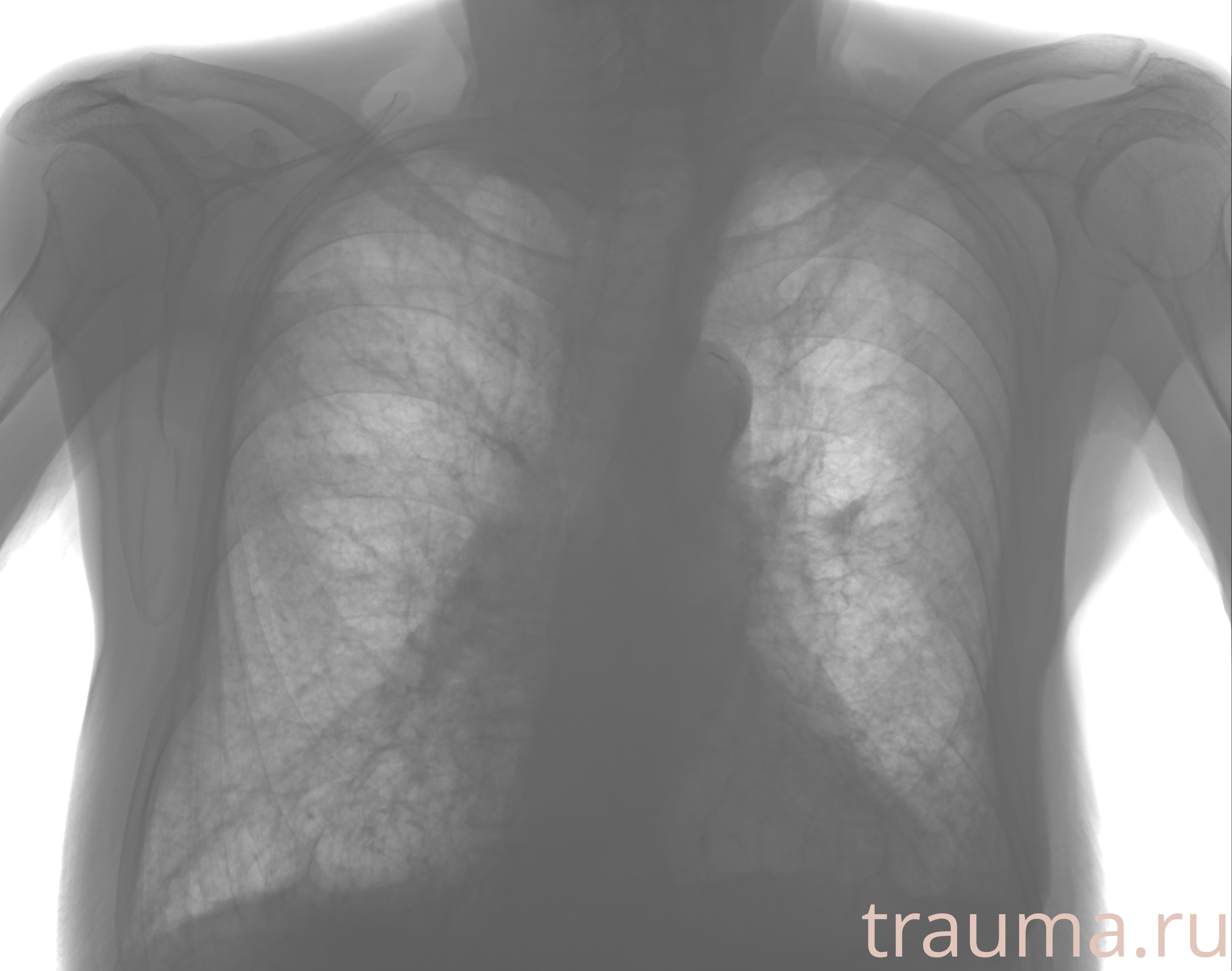 Рентген на дому: по вашему адресу приезжает врач-рентгенолог, травматолог-ортопед с мобильным рентгеновским аппаратом, проводит диагностику травмы или заболевания, делает необходимые рентгенограммы, дает рекомендации по дальнейшему лечению. Получить качественные снимки в домашних условиях возможно благодаря уникальной методике, разработанной МосРентген Центром для института  Склифосовского