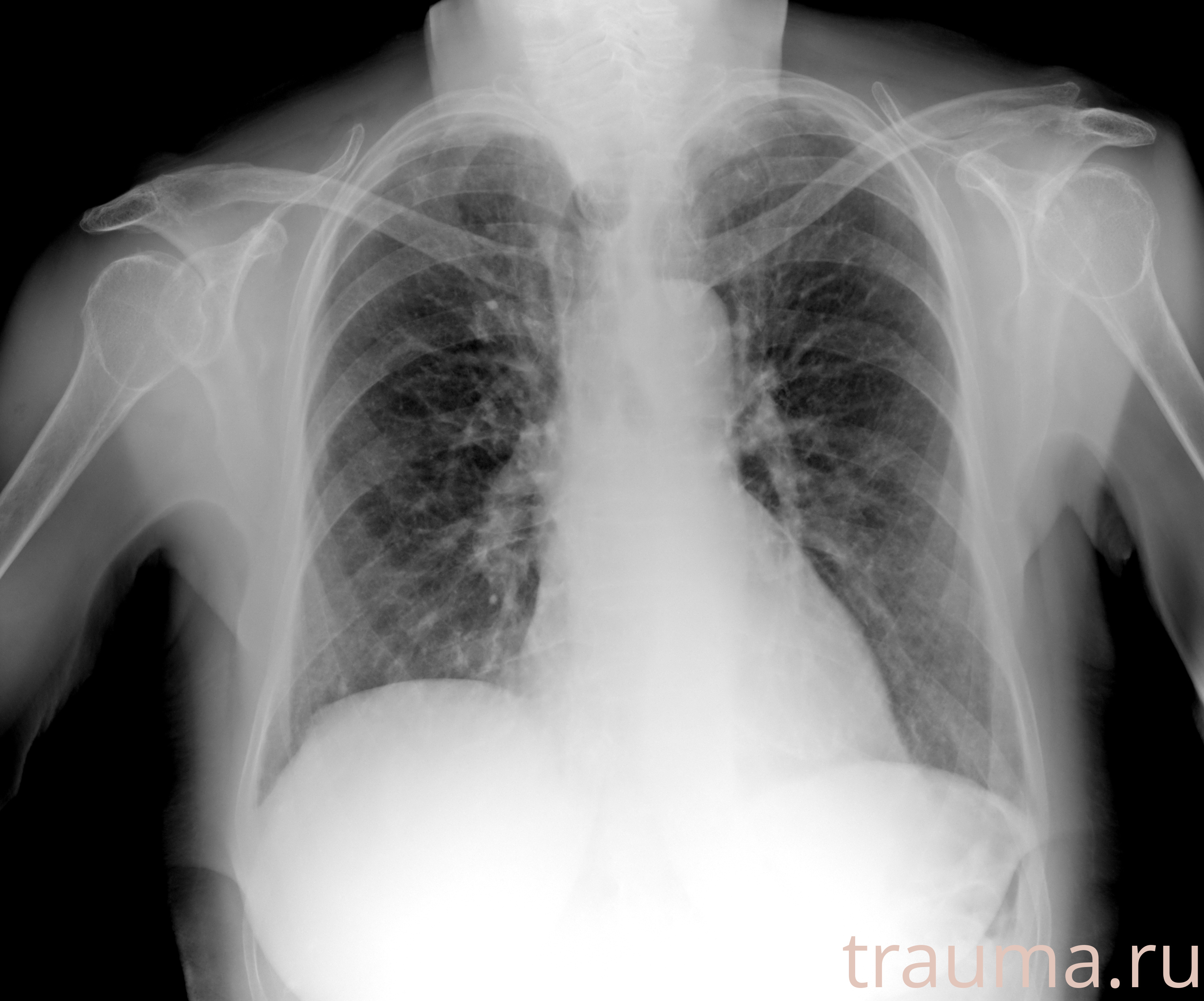 Рентген на дому: по вашему адресу приезжает врач-рентгенолог, травматолог-ортопед с мобильным рентгеновским аппаратом, проводит диагностику травмы или заболевания, делает необходимые рентгенограммы, дает рекомендации по дальнейшему лечению. Получить качественные снимки в домашних условиях возможно благодаря уникальной методике, разработанной МосРентген Центром для института  Склифосовского