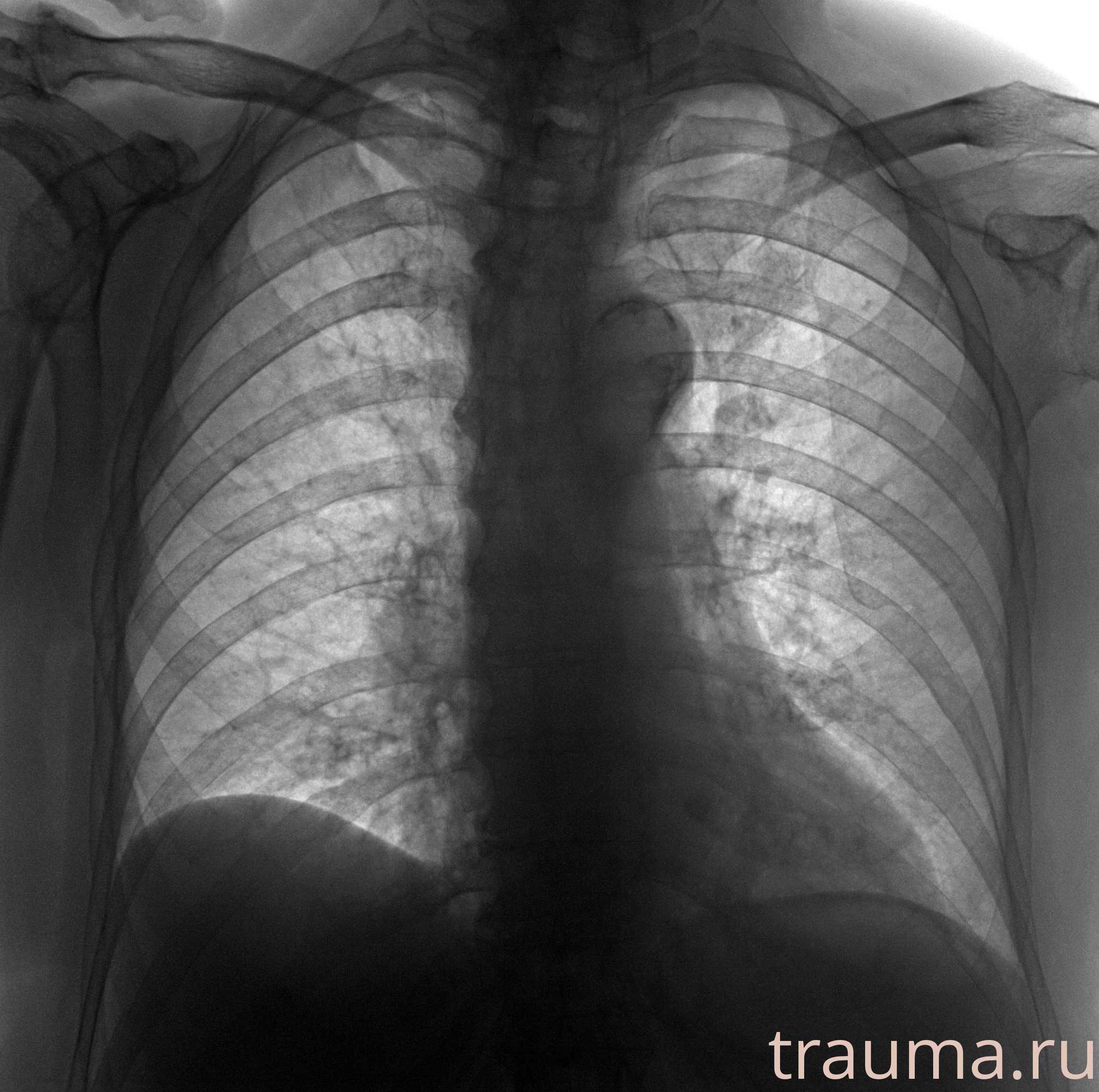 Рентген на дому: по вашему адресу приезжает врач-рентгенолог, травматолог-ортопед с мобильным рентгеновским аппаратом, проводит диагностику травмы или заболевания, делает необходимые рентгенограммы, дает рекомендации по дальнейшему лечению. Получить качественные снимки в домашних условиях возможно благодаря уникальной методике, разработанной МосРентген Центром для института  Склифосовского