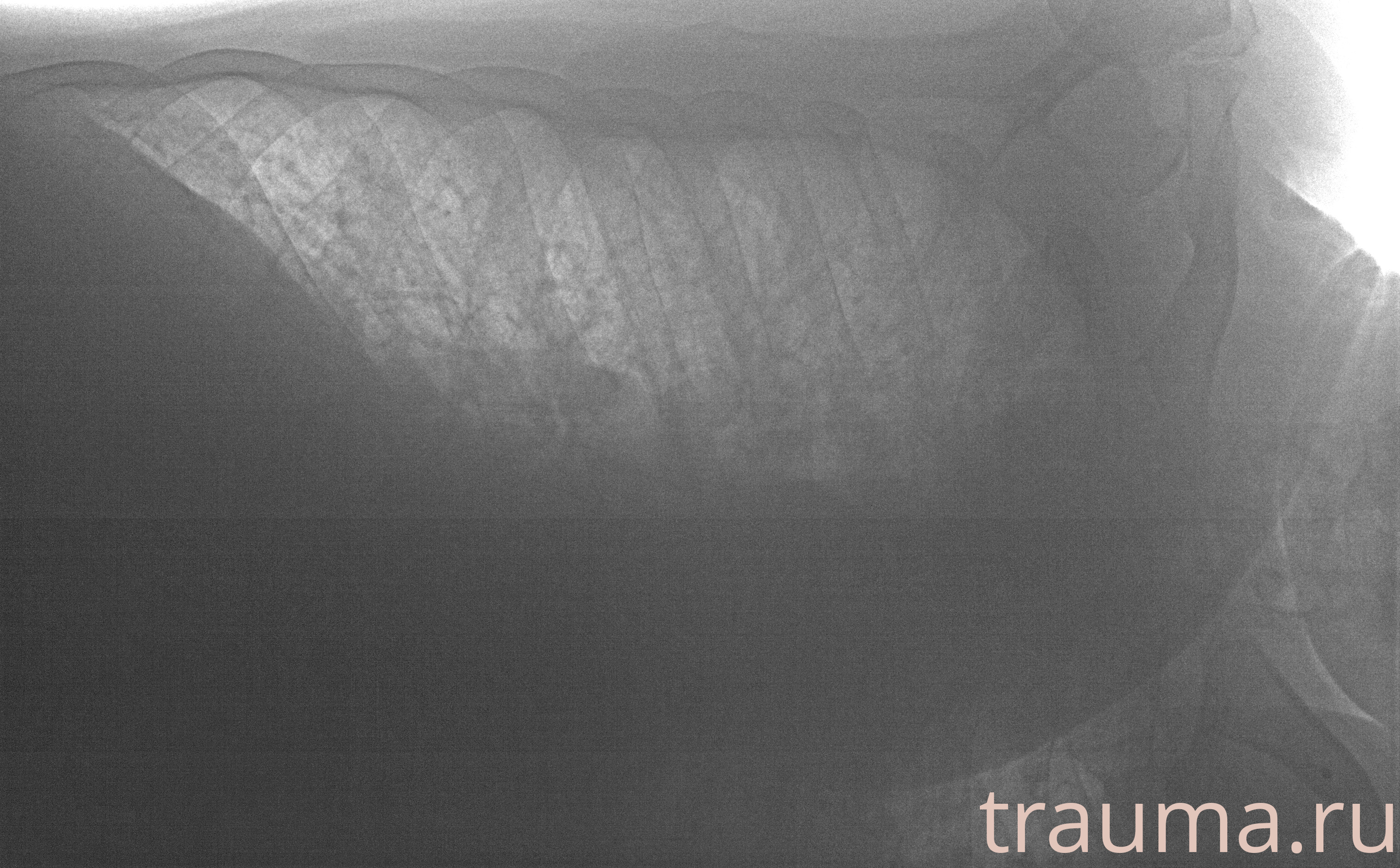 Рентген на дому: по вашему адресу приезжает врач-рентгенолог, травматолог-ортопед с мобильным рентгеновским аппаратом, проводит диагностику травмы или заболевания, делает необходимые рентгенограммы, дает рекомендации по дальнейшему лечению. Получить качественные снимки в домашних условиях возможно благодаря уникальной методике, разработанной МосРентген Центром для института  Склифосовского
