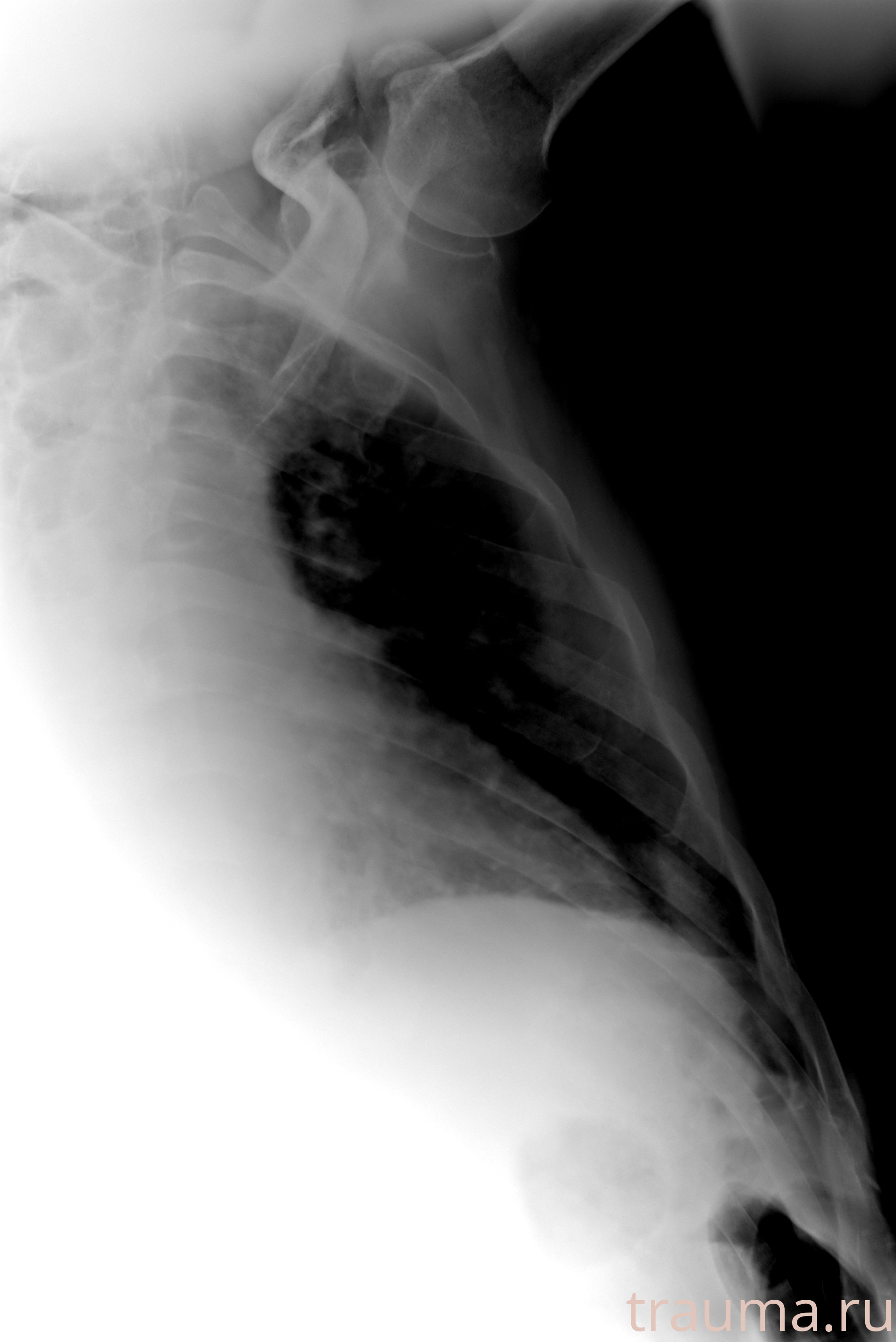 Рентген на дому: по вашему адресу приезжает врач-рентгенолог, травматолог-ортопед с мобильным рентгеновским аппаратом, проводит диагностику травмы или заболевания, делает необходимые рентгенограммы, дает рекомендации по дальнейшему лечению. Получить качественные снимки в домашних условиях возможно благодаря уникальной методике, разработанной МосРентген Центром для института  Склифосовского