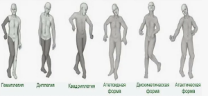 Основные этиологические факторы и коморбидная патология тяжелых форм детского церебрального паралича