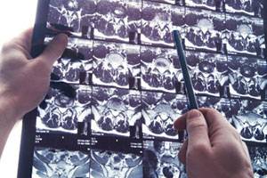Характеристика методов лучевой диагностики:компьютерная рентгеновская томография
