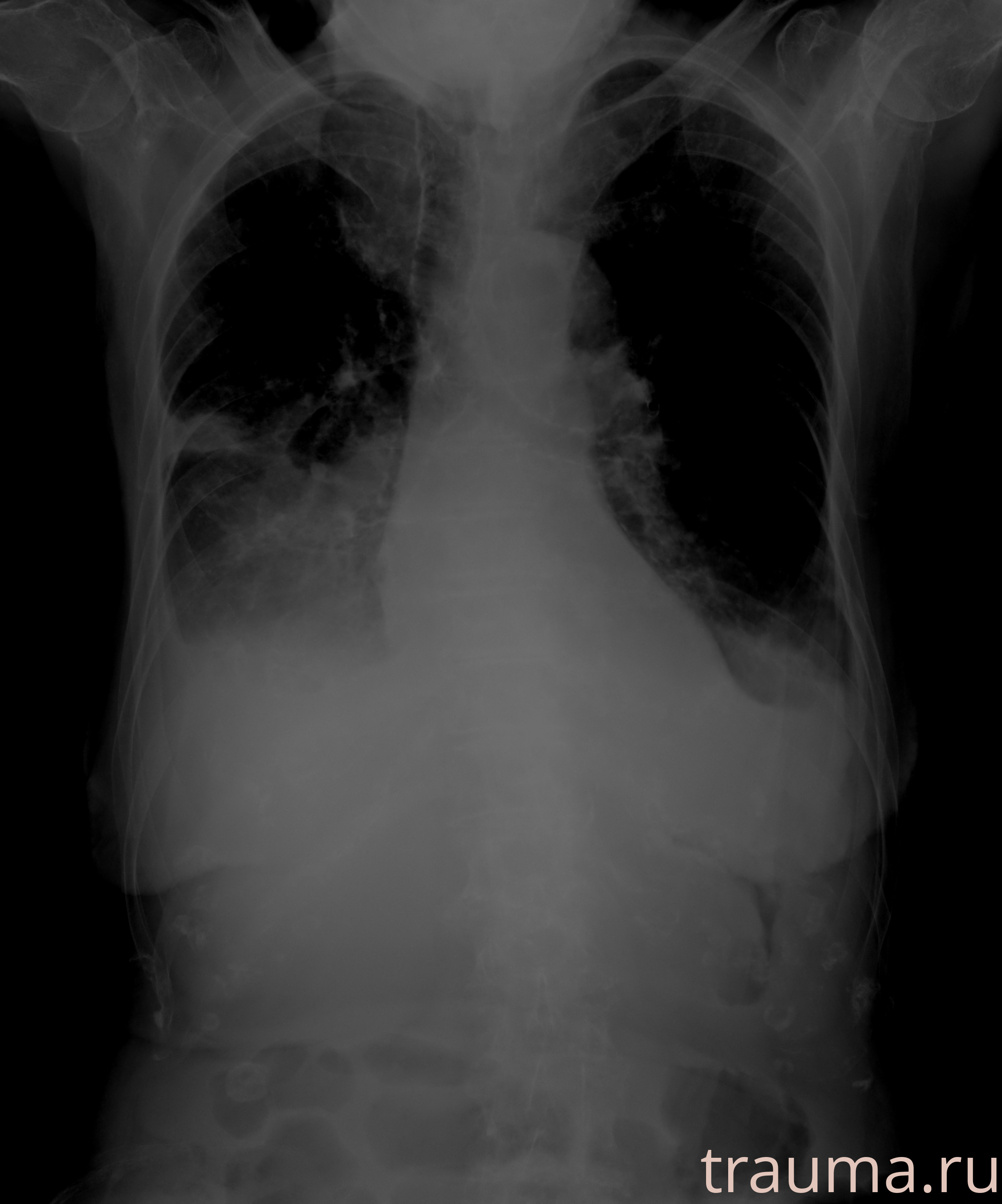 Рентген на дому: по вашему адресу приезжает врач-рентгенолог, травматолог-ортопед с мобильным рентгеновским аппаратом, проводит диагностику травмы или заболевания, делает необходимые рентгенограммы, дает рекомендации по дальнейшему лечению. Получить качественные снимки в домашних условиях возможно благодаря уникальной методике, разработанной МосРентген Центром для института  Склифосовского