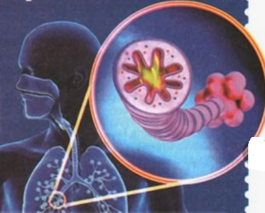 Структура смертности людей с хронической обструктивной болезнью легких