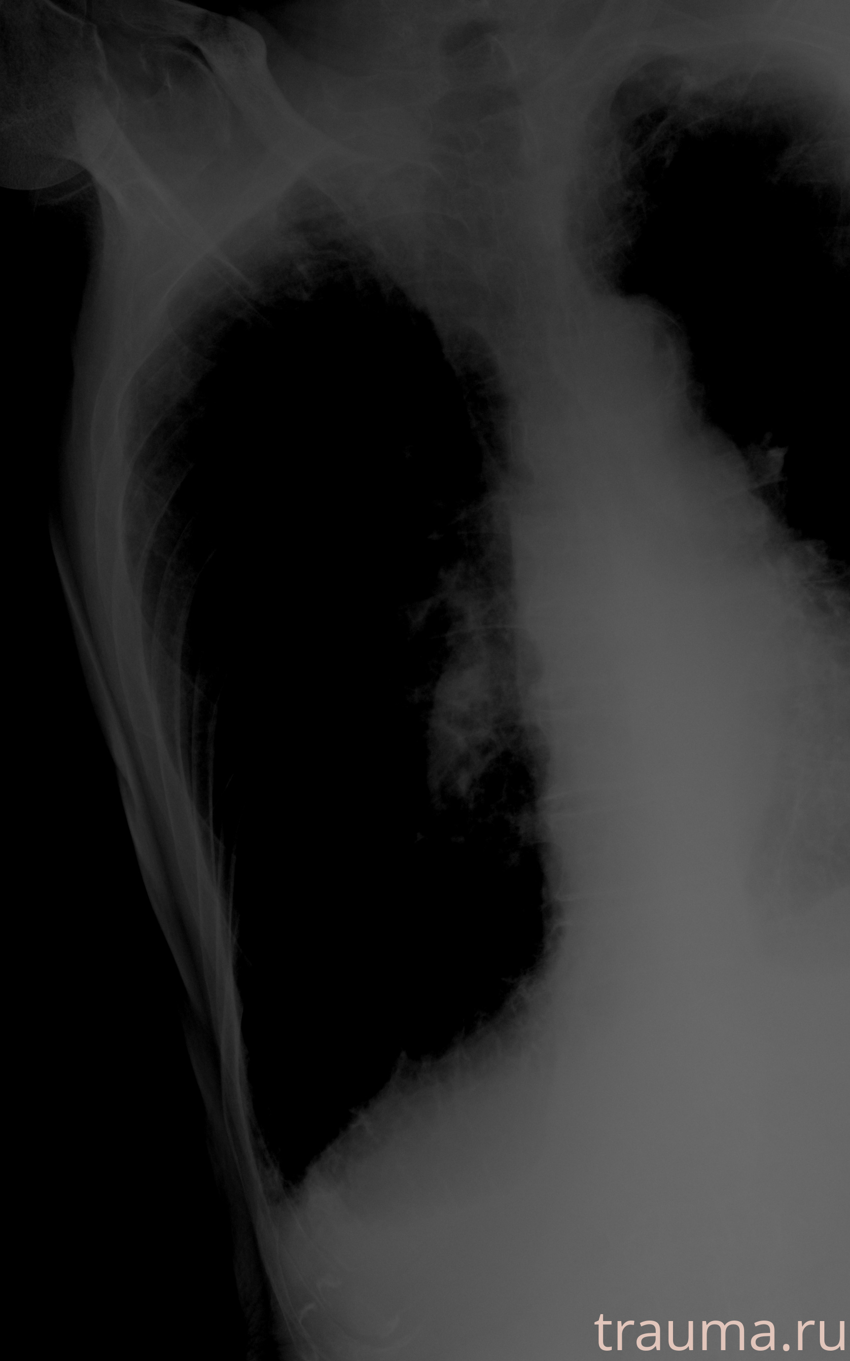 Рентген на дому: по вашему адресу приезжает врач-рентгенолог, травматолог-ортопед с мобильным рентгеновским аппаратом, проводит диагностику травмы или заболевания, делает необходимые рентгенограммы, дает рекомендации по дальнейшему лечению. Получить качественные снимки в домашних условиях возможно благодаря уникальной методике, разработанной МосРентген Центром для института  Склифосовского