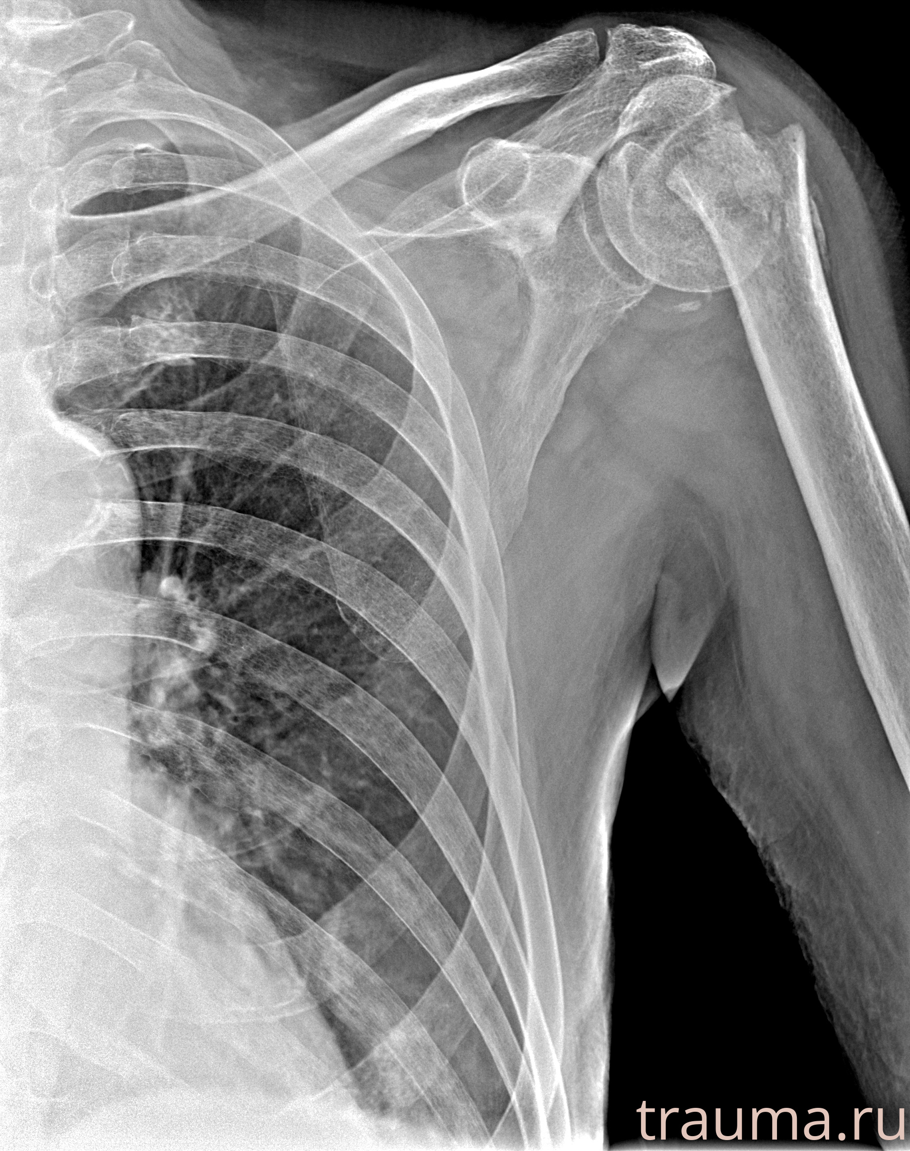 Рентген на дому: по вашему адресу приезжает врач-рентгенолог, травматолог-ортопед с мобильным рентгеновским аппаратом, проводит диагностику травмы или заболевания, делает необходимые рентгенограммы, дает рекомендации по дальнейшему лечению. Получить качественные снимки в домашних условиях возможно благодаря уникальной методике, разработанной МосРентген Центром для института  Склифосовского