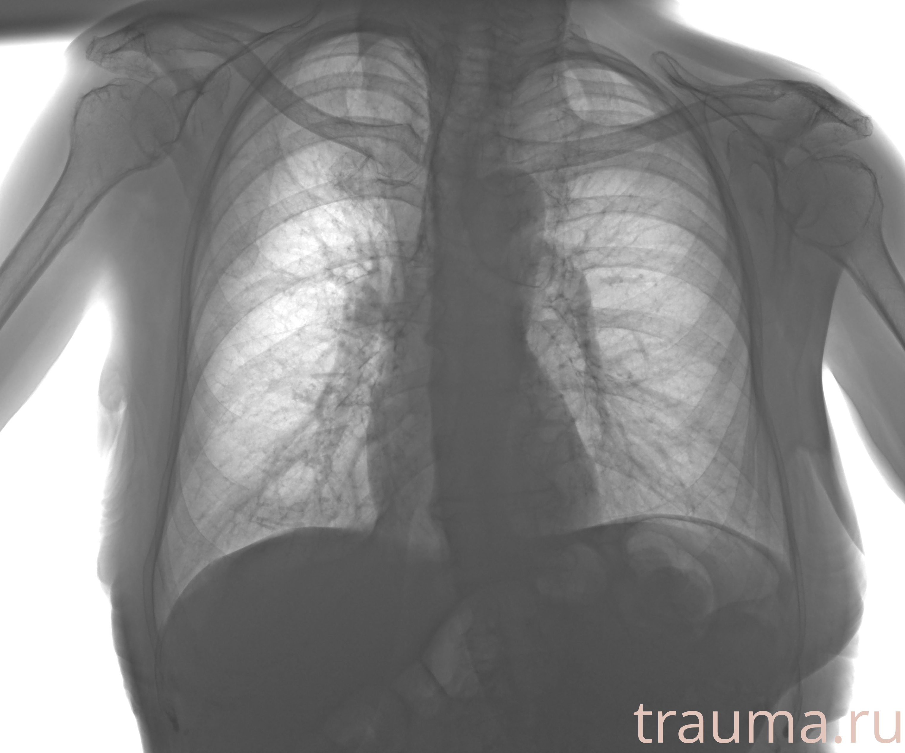 Рентген на дому: по вашему адресу приезжает врач-рентгенолог, травматолог-ортопед с мобильным рентгеновским аппаратом, проводит диагностику травмы или заболевания, делает необходимые рентгенограммы, дает рекомендации по дальнейшему лечению. Получить качественные снимки в домашних условиях возможно благодаря уникальной методике, разработанной МосРентген Центром для института  Склифосовского