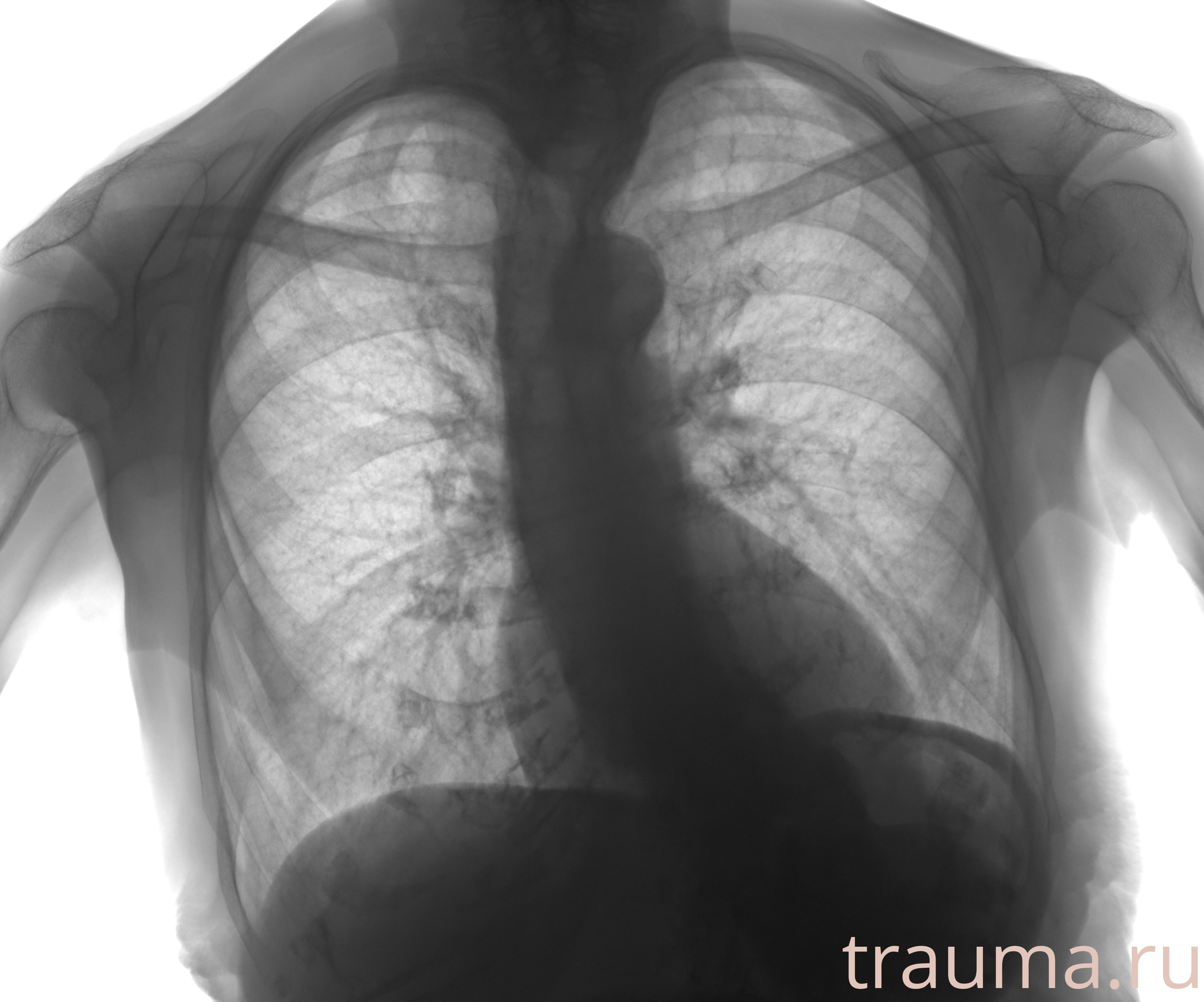 Рентген на дому: по вашему адресу приезжает врач-рентгенолог, травматолог-ортопед с мобильным рентгеновским аппаратом, проводит диагностику травмы или заболевания, делает необходимые рентгенограммы, дает рекомендации по дальнейшему лечению. Получить качественные снимки в домашних условиях возможно благодаря уникальной методике, разработанной МосРентген Центром для института  Склифосовского