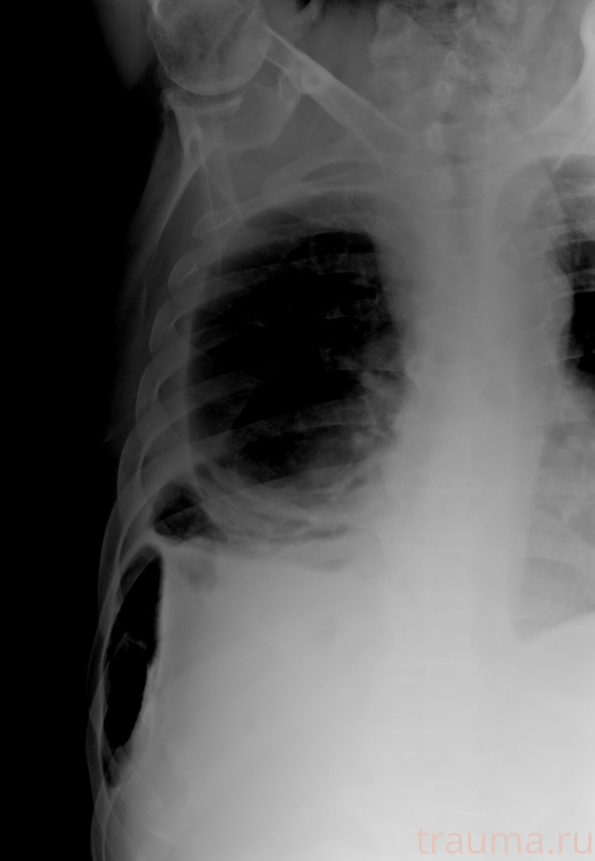 Рентген на дому: по вашему адресу приезжает врач-рентгенолог, травматолог-ортопед с мобильным рентгеновским аппаратом, проводит диагностику травмы или заболевания, делает необходимые рентгенограммы, дает рекомендации по дальнейшему лечению. Получить качественные снимки в домашних условиях возможно благодаря уникальной методике, разработанной МосРентген Центром для института  Склифосовского