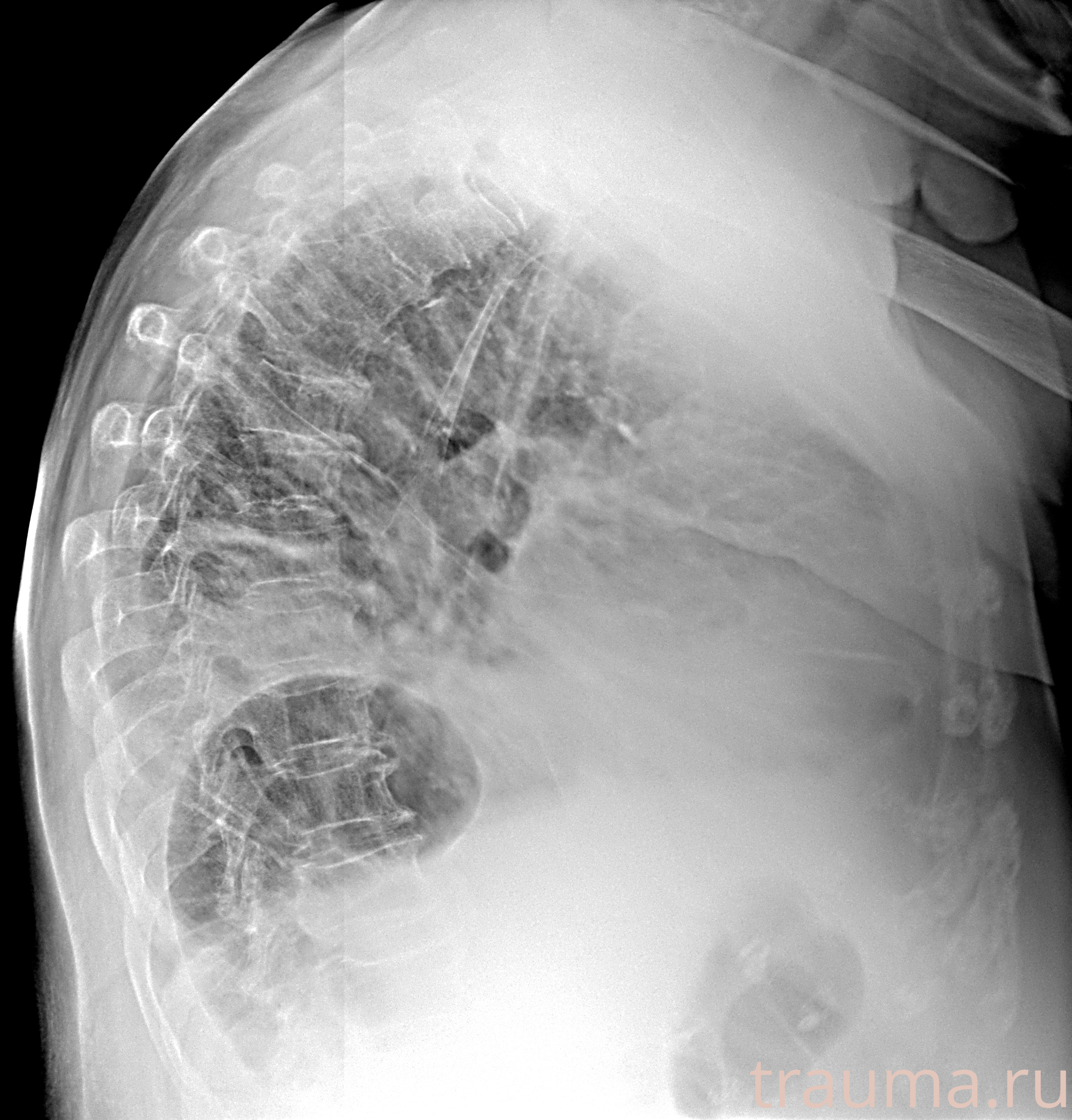 Рентген на дому: по вашему адресу приезжает врач-рентгенолог, травматолог-ортопед с мобильным рентгеновским аппаратом, проводит диагностику травмы или заболевания, делает необходимые рентгенограммы, дает рекомендации по дальнейшему лечению. Получить качественные снимки в домашних условиях возможно благодаря уникальной методике, разработанной МосРентген Центром для института  Склифосовского