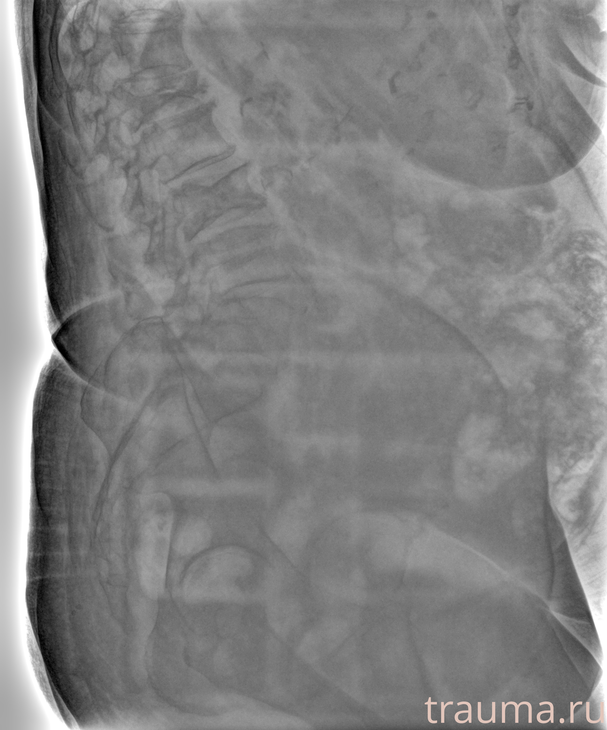 Рентген на дому: по вашему адресу приезжает врач-рентгенолог, травматолог-ортопед с мобильным рентгеновским аппаратом, проводит диагностику травмы или заболевания, делает необходимые рентгенограммы, дает рекомендации по дальнейшему лечению. Получить качественные снимки в домашних условиях возможно благодаря уникальной методике, разработанной МосРентген Центром для института  Склифосовского