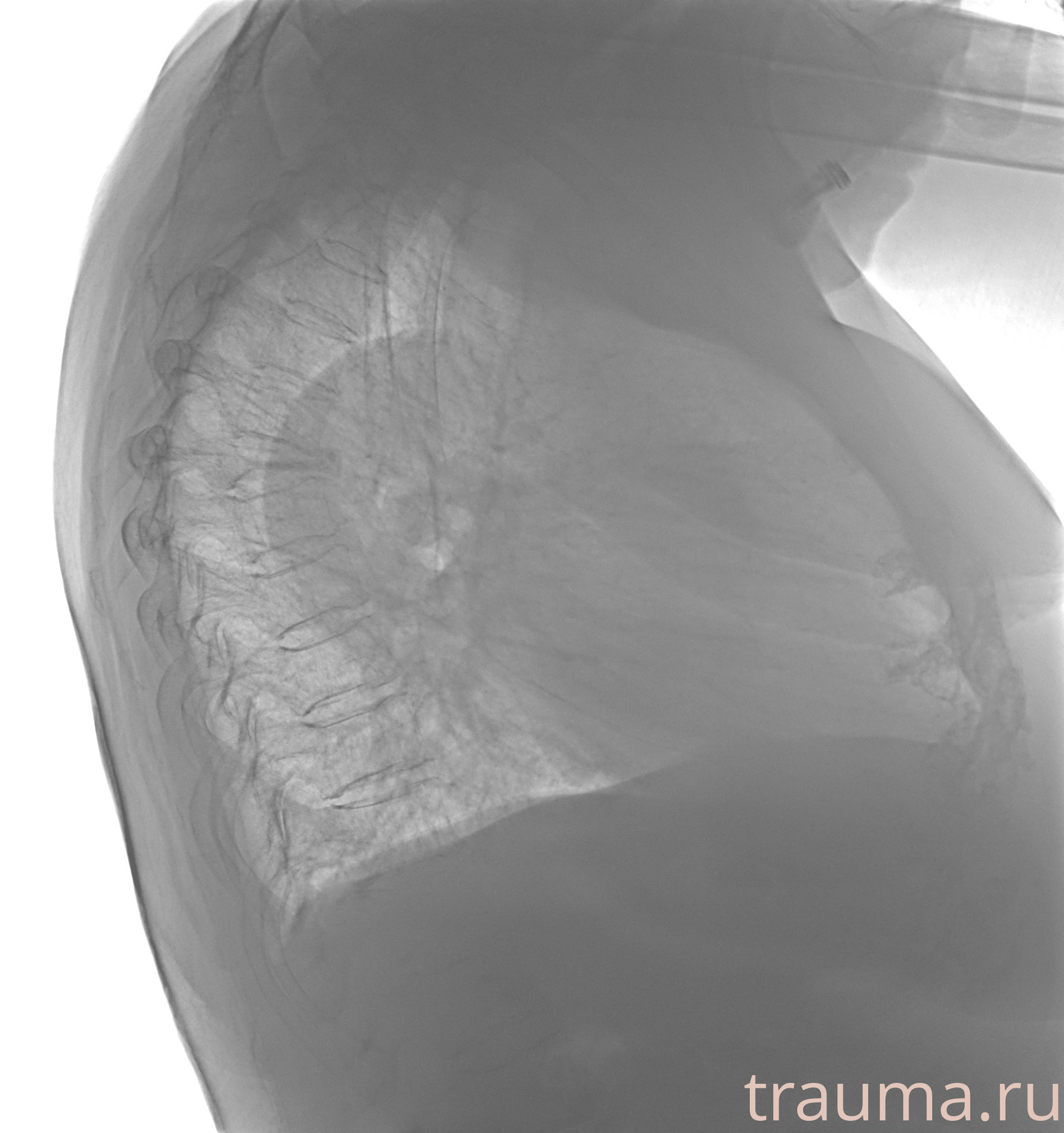 Рентген на дому: по вашему адресу приезжает врач-рентгенолог, травматолог-ортопед с мобильным рентгеновским аппаратом, проводит диагностику травмы или заболевания, делает необходимые рентгенограммы, дает рекомендации по дальнейшему лечению. Получить качественные снимки в домашних условиях возможно благодаря уникальной методике, разработанной МосРентген Центром для института  Склифосовского