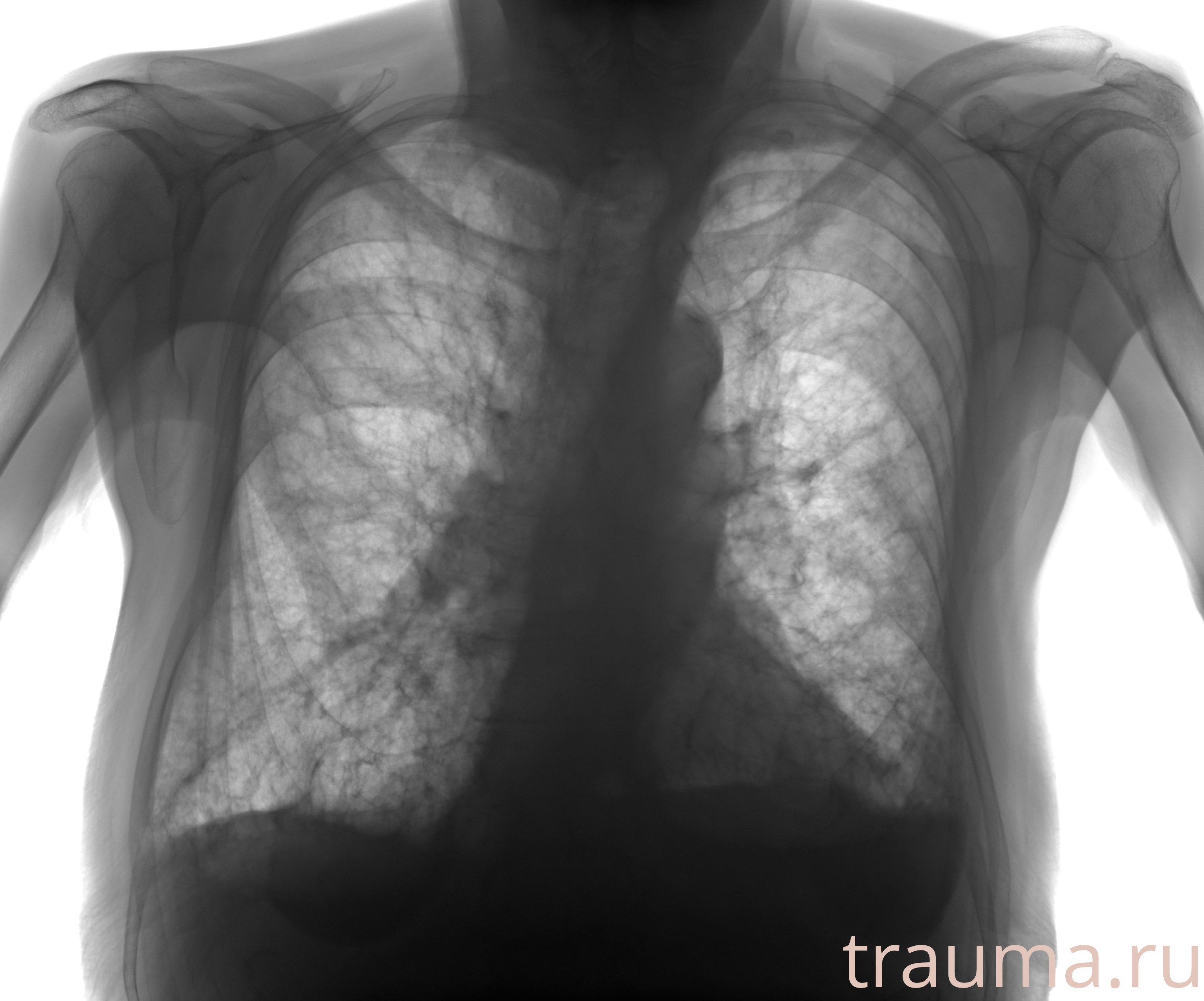 Рентген на дому: по вашему адресу приезжает врач-рентгенолог, травматолог-ортопед с мобильным рентгеновским аппаратом, проводит диагностику травмы или заболевания, делает необходимые рентгенограммы, дает рекомендации по дальнейшему лечению. Получить качественные снимки в домашних условиях возможно благодаря уникальной методике, разработанной МосРентген Центром для института  Склифосовского