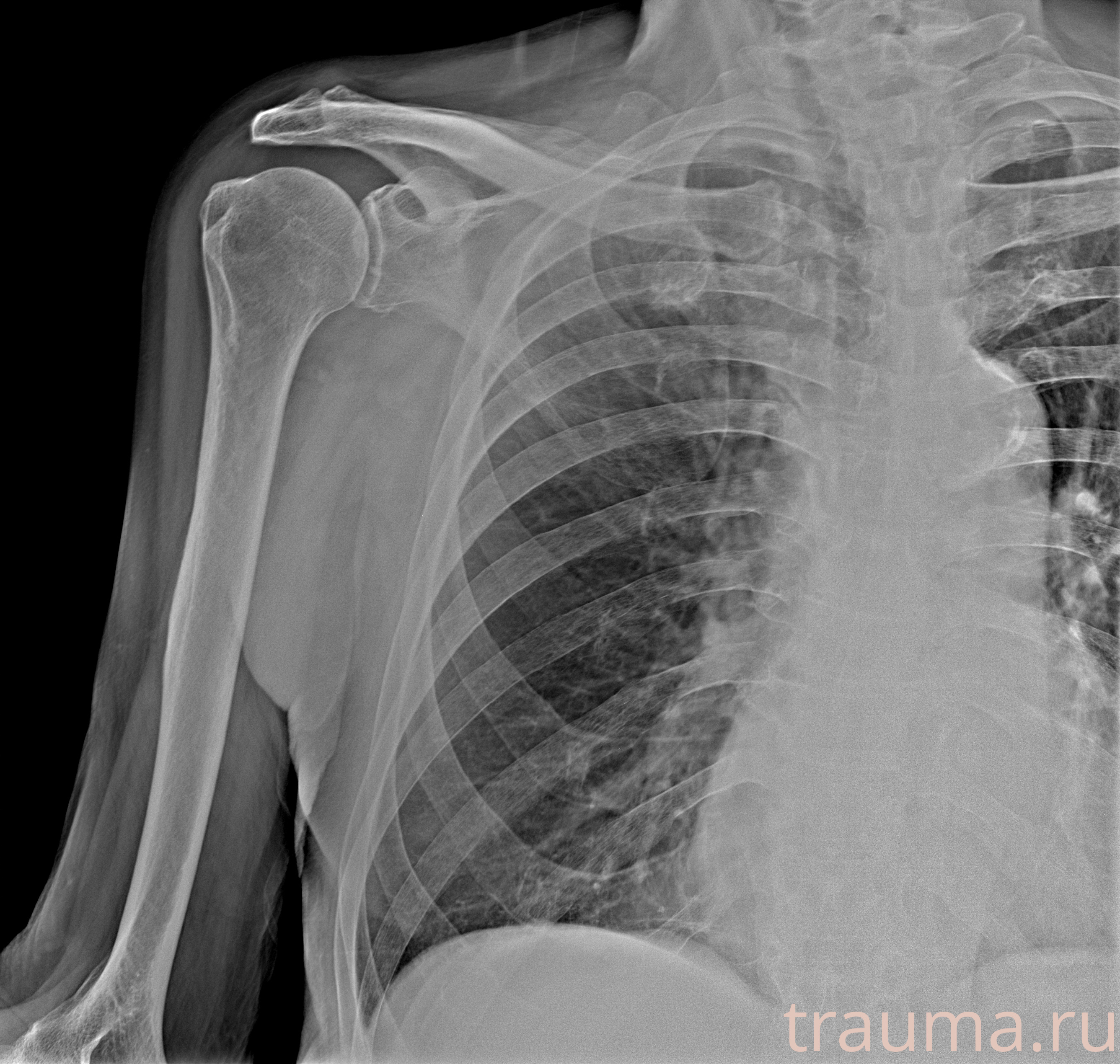 Рентген на дому: по вашему адресу приезжает врач-рентгенолог, травматолог-ортопед с мобильным рентгеновским аппаратом, проводит диагностику травмы или заболевания, делает необходимые рентгенограммы, дает рекомендации по дальнейшему лечению. Получить качественные снимки в домашних условиях возможно благодаря уникальной методике, разработанной МосРентген Центром для института  Склифосовского