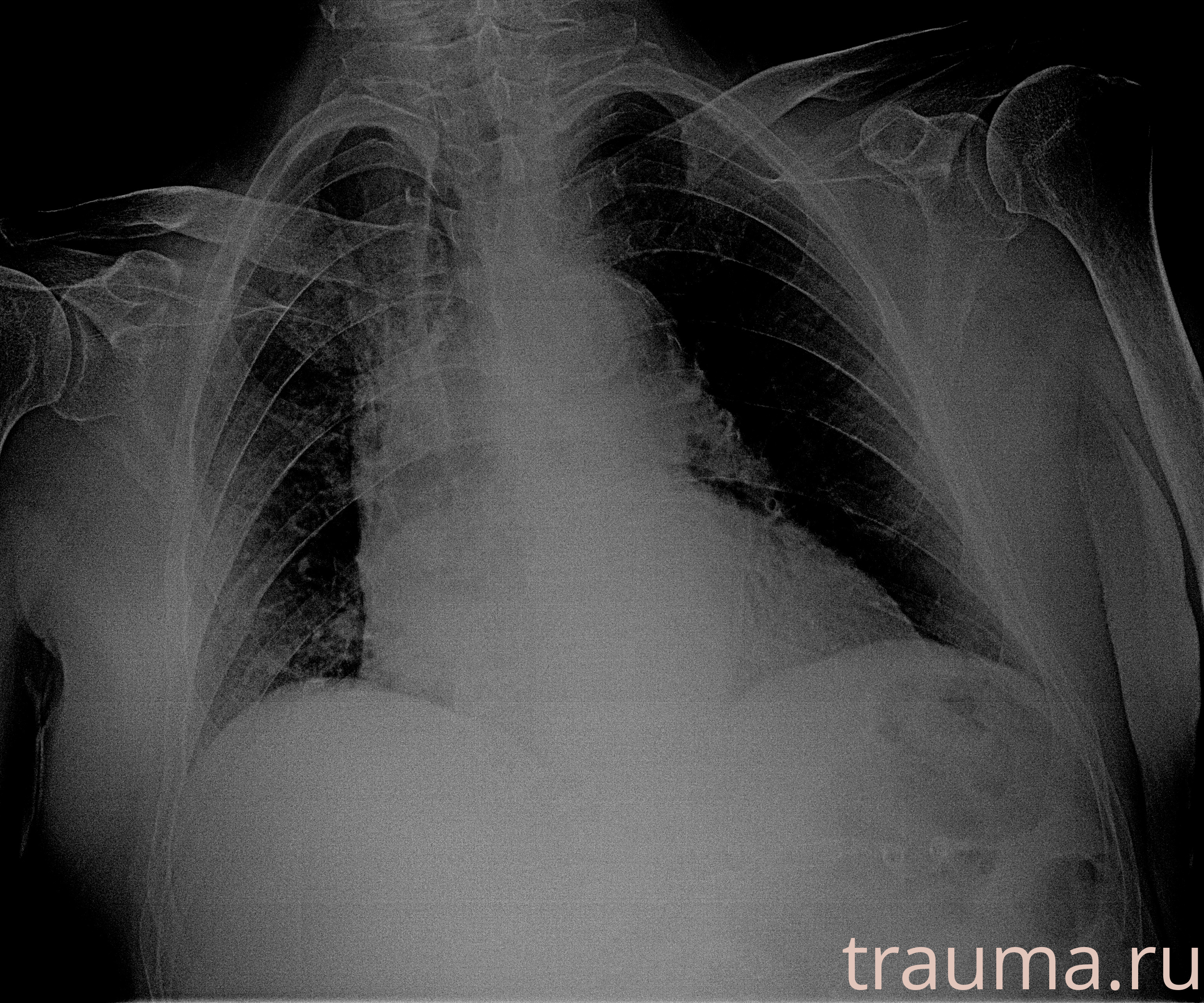 Рентген на дому: по вашему адресу приезжает врач-рентгенолог, травматолог-ортопед с мобильным рентгеновским аппаратом, проводит диагностику травмы или заболевания, делает необходимые рентгенограммы, дает рекомендации по дальнейшему лечению. Получить качественные снимки в домашних условиях возможно благодаря уникальной методике, разработанной МосРентген Центром для института  Склифосовского