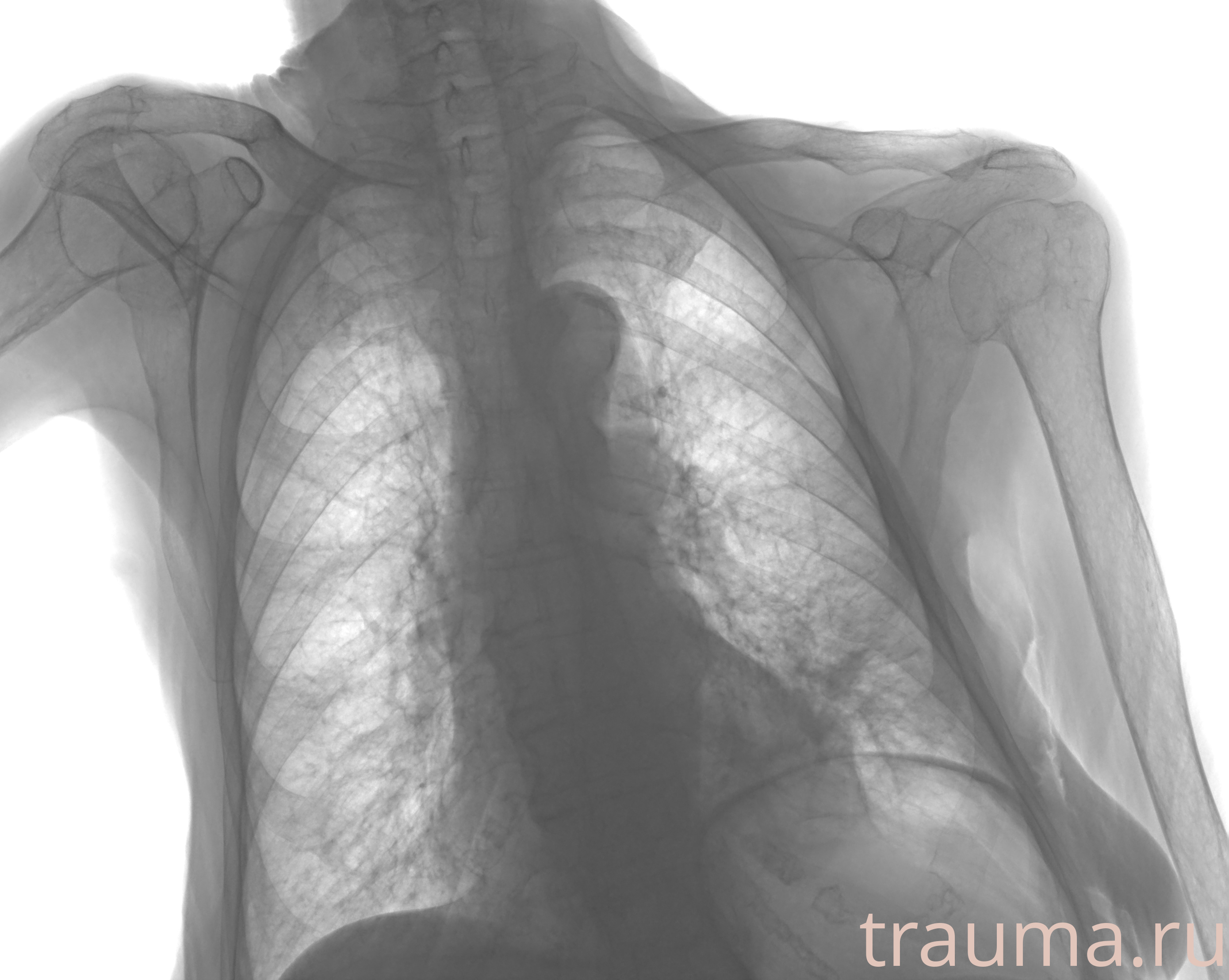 Рентген на дому: по вашему адресу приезжает врач-рентгенолог, травматолог-ортопед с мобильным рентгеновским аппаратом, проводит диагностику травмы или заболевания, делает необходимые рентгенограммы, дает рекомендации по дальнейшему лечению. Получить качественные снимки в домашних условиях возможно благодаря уникальной методике, разработанной МосРентген Центром для института  Склифосовского