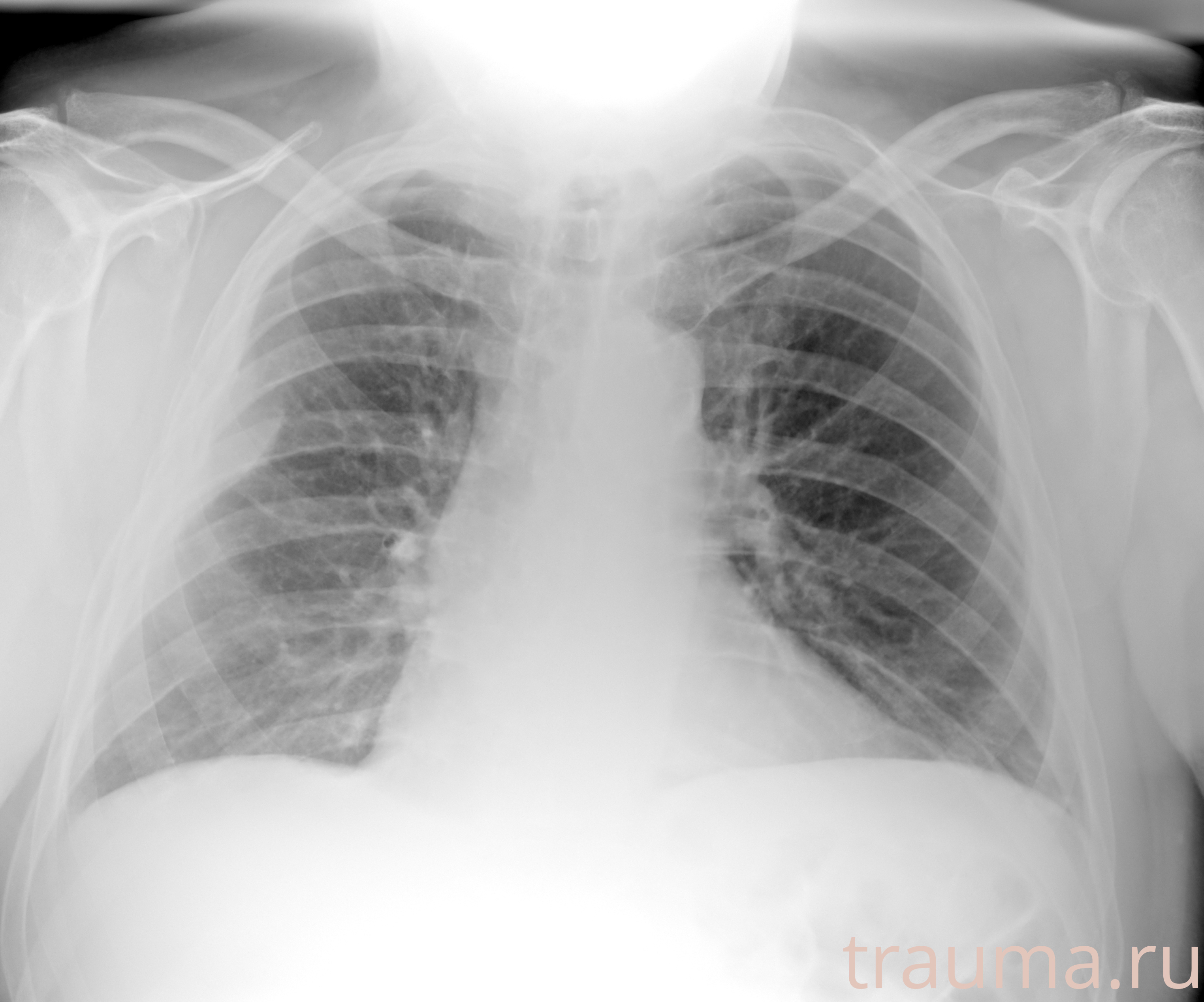 Рентген на дому: по вашему адресу приезжает врач-рентгенолог, травматолог-ортопед с мобильным рентгеновским аппаратом, проводит диагностику травмы или заболевания, делает необходимые рентгенограммы, дает рекомендации по дальнейшему лечению. Получить качественные снимки в домашних условиях возможно благодаря уникальной методике, разработанной МосРентген Центром для института  Склифосовского