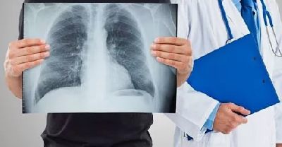 Новосибирский студент оказался на операционном столе после флюорографии