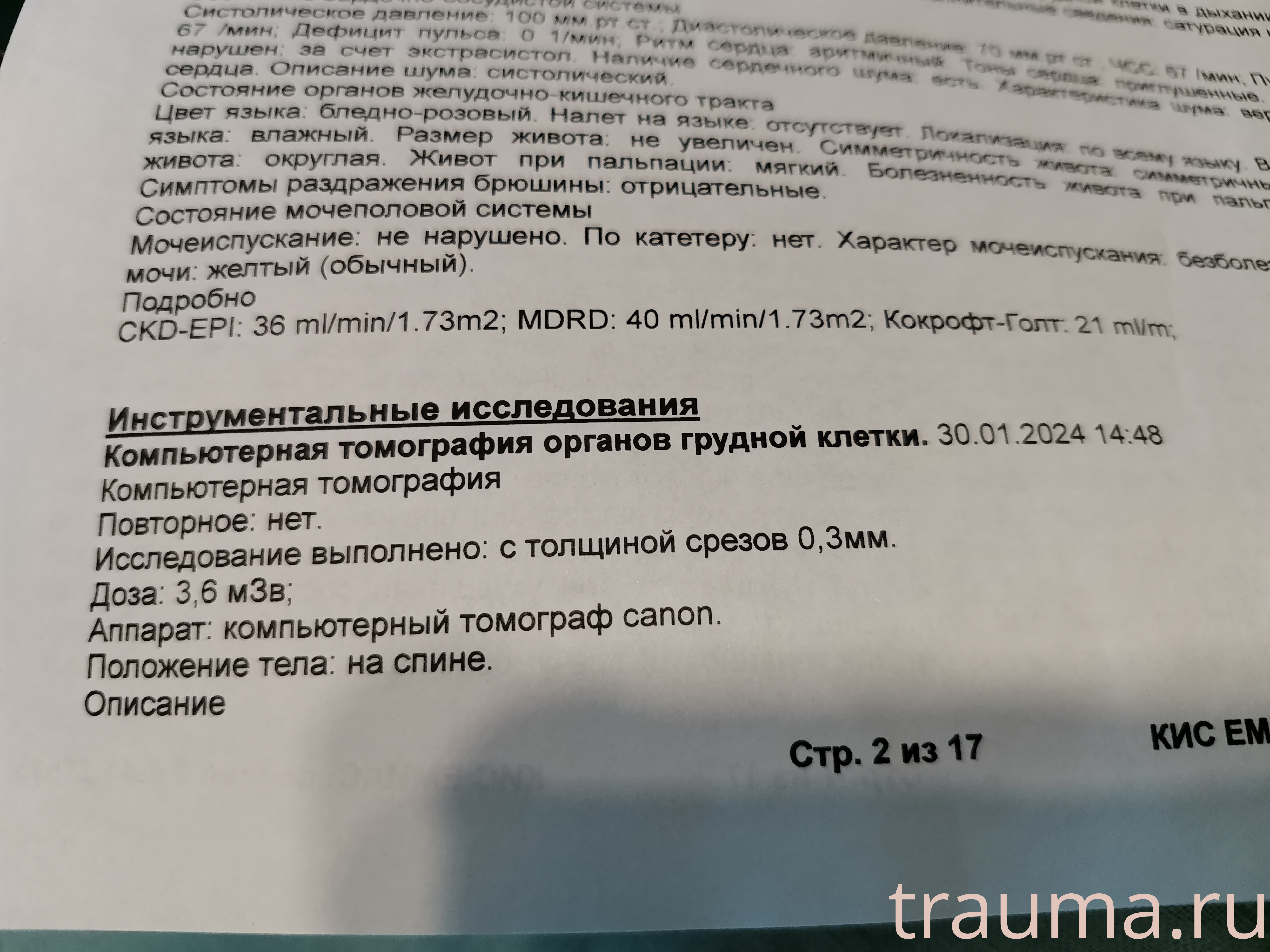 Рентген на дому: по вашему адресу приезжает врач-рентгенолог, травматолог-ортопед с мобильным рентгеновским аппаратом, проводит диагностику травмы или заболевания, делает необходимые рентгенограммы, дает рекомендации по дальнейшему лечению. Получить качественные снимки в домашних условиях возможно благодаря уникальной методике, разработанной МосРентген Центром для института  Склифосовского