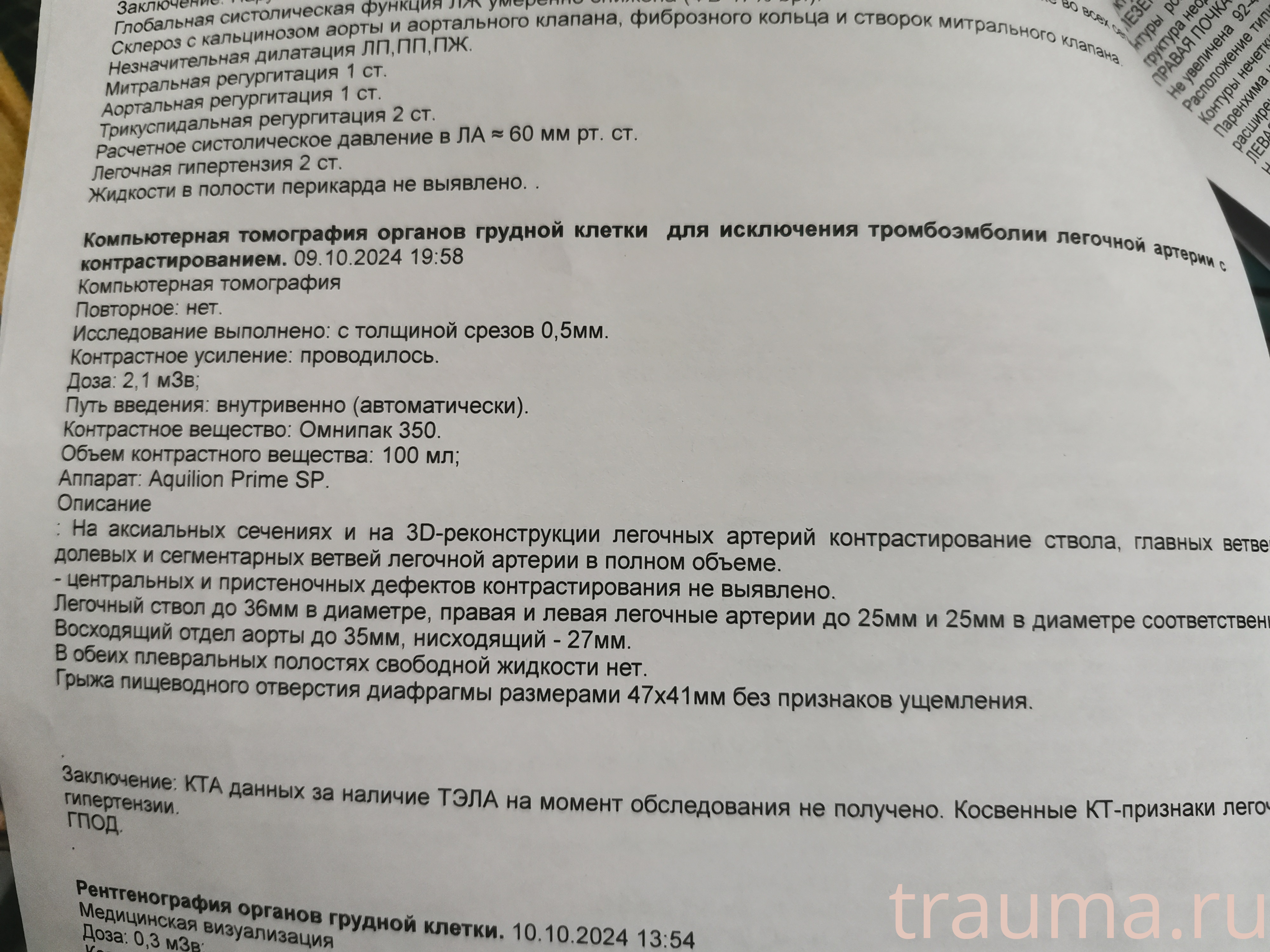 Рентген на дому: по вашему адресу приезжает врач-рентгенолог, травматолог-ортопед с мобильным рентгеновским аппаратом, проводит диагностику травмы или заболевания, делает необходимые рентгенограммы, дает рекомендации по дальнейшему лечению. Получить качественные снимки в домашних условиях возможно благодаря уникальной методике, разработанной МосРентген Центром для института  Склифосовского