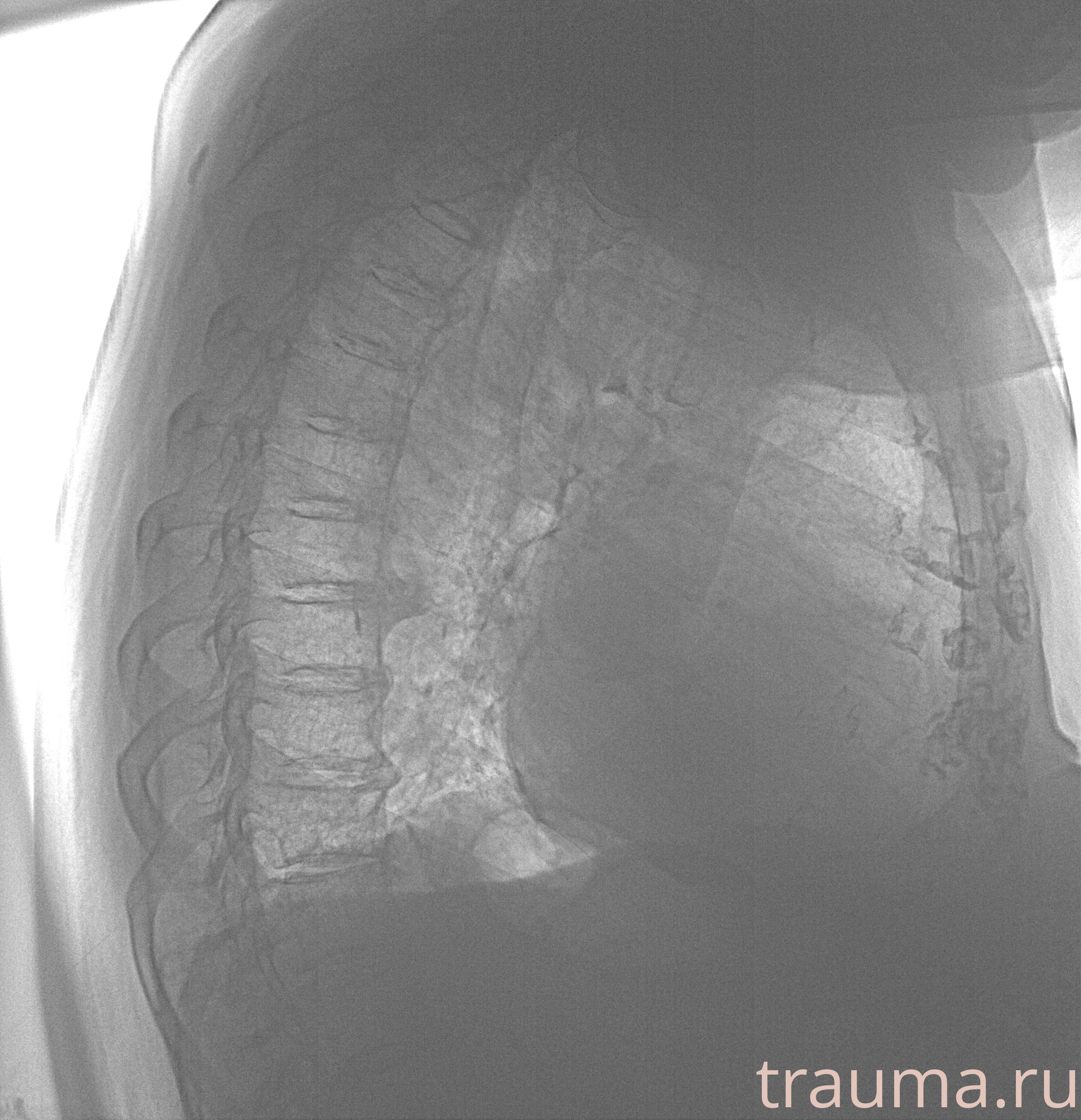Рентген на дому: по вашему адресу приезжает врач-рентгенолог, травматолог-ортопед с мобильным рентгеновским аппаратом, проводит диагностику травмы или заболевания, делает необходимые рентгенограммы, дает рекомендации по дальнейшему лечению. Получить качественные снимки в домашних условиях возможно благодаря уникальной методике, разработанной МосРентген Центром для института  Склифосовского