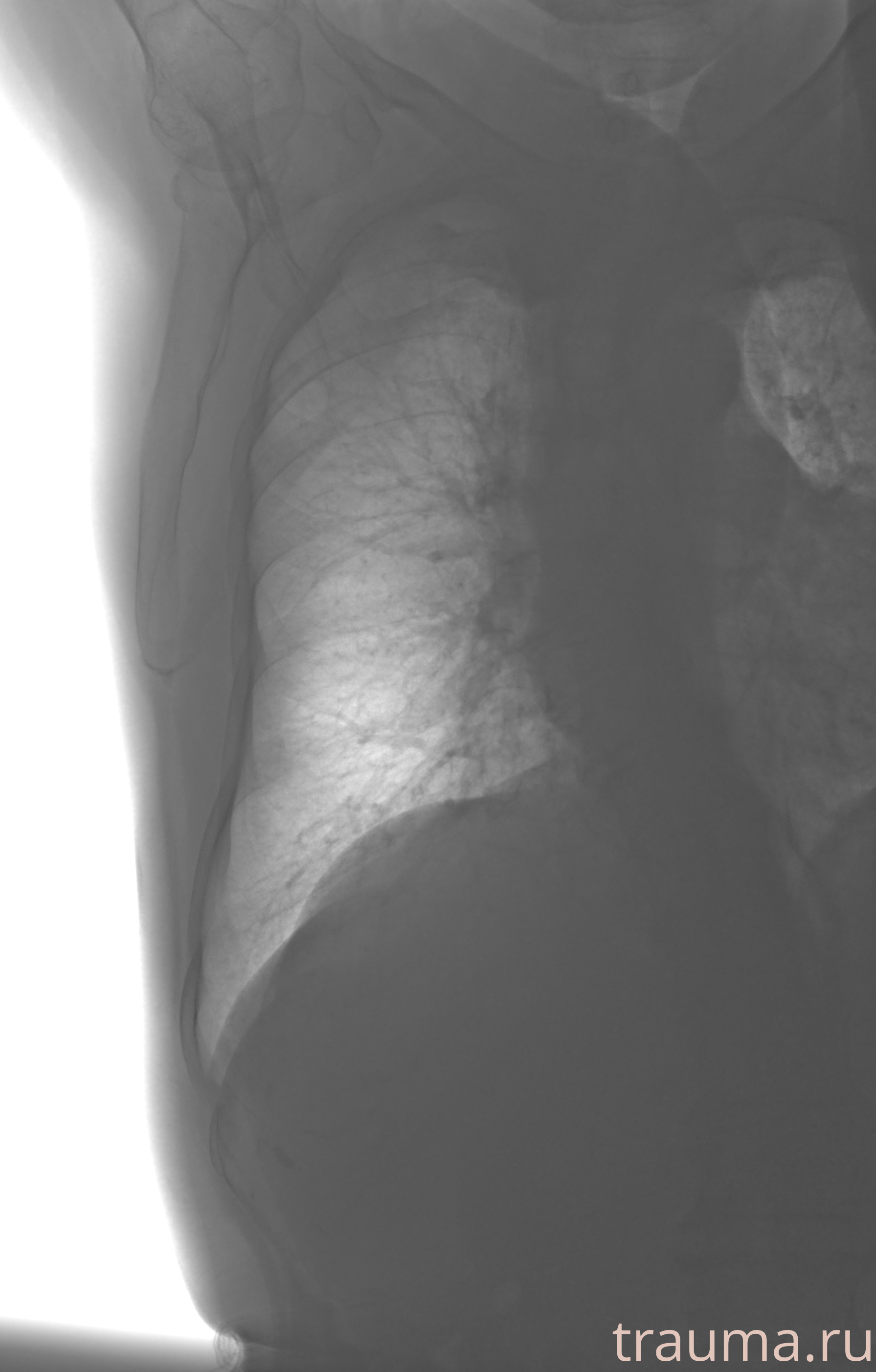 Рентген на дому: по вашему адресу приезжает врач-рентгенолог, травматолог-ортопед с мобильным рентгеновским аппаратом, проводит диагностику травмы или заболевания, делает необходимые рентгенограммы, дает рекомендации по дальнейшему лечению. Получить качественные снимки в домашних условиях возможно благодаря уникальной методике, разработанной МосРентген Центром для института  Склифосовского