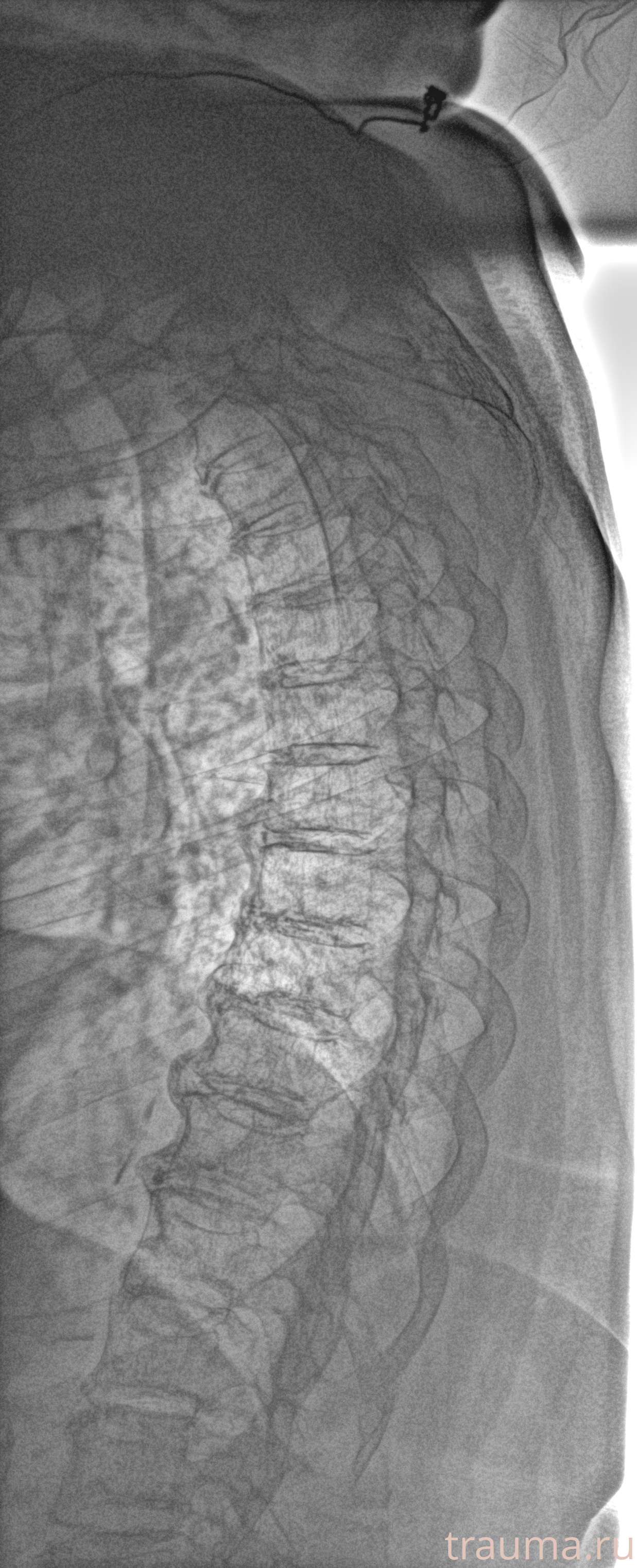Рентген на дому: по вашему адресу приезжает врач-рентгенолог, травматолог-ортопед с мобильным рентгеновским аппаратом, проводит диагностику травмы или заболевания, делает необходимые рентгенограммы, дает рекомендации по дальнейшему лечению. Получить качественные снимки в домашних условиях возможно благодаря уникальной методике, разработанной МосРентген Центром для института  Склифосовского