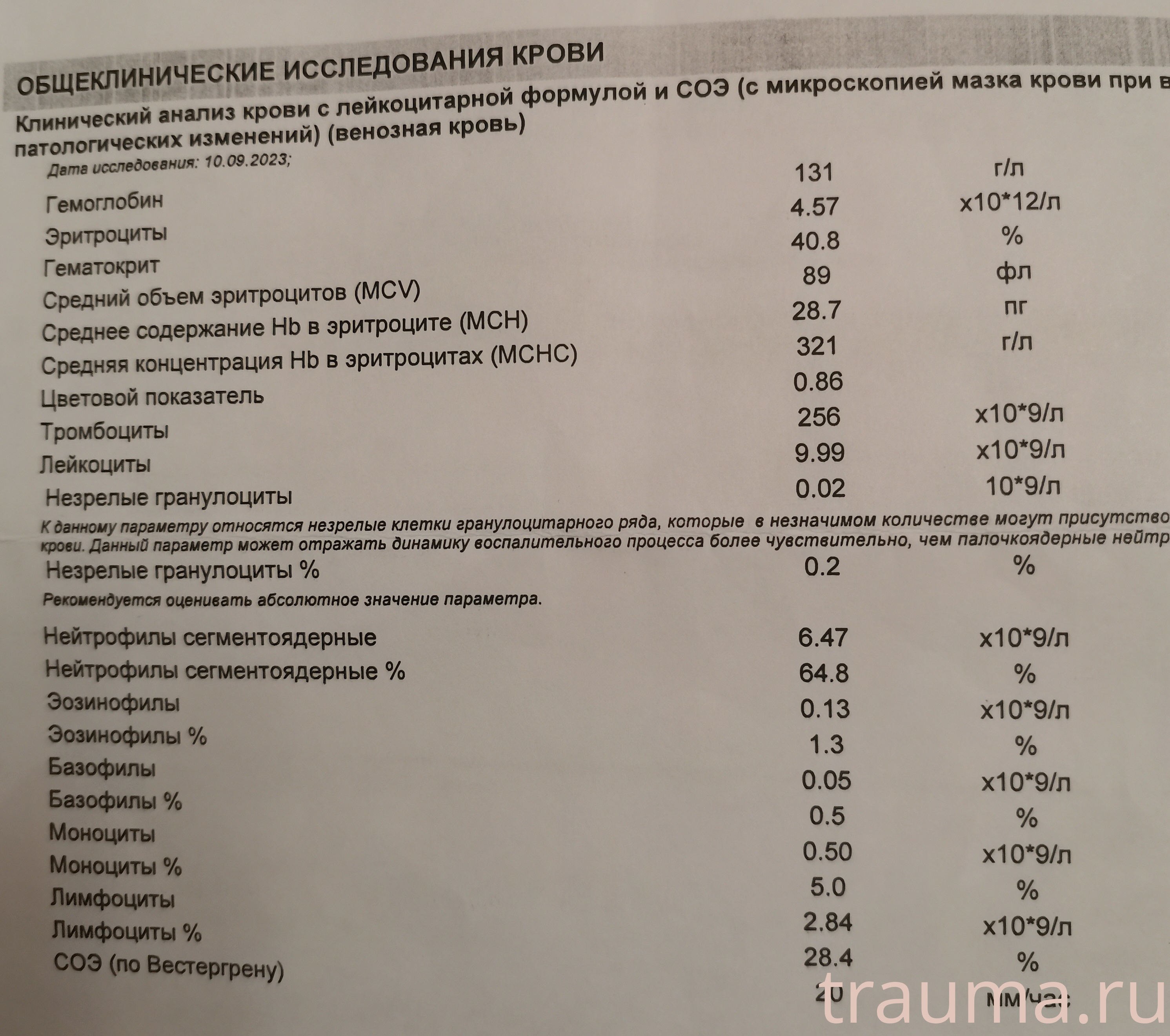 Рентген на дому: по вашему адресу приезжает врач-рентгенолог, травматолог-ортопед с мобильным рентгеновским аппаратом, проводит диагностику травмы или заболевания, делает необходимые рентгенограммы, дает рекомендации по дальнейшему лечению. Получить качественные снимки в домашних условиях возможно благодаря уникальной методике, разработанной МосРентген Центром для института  Склифосовского