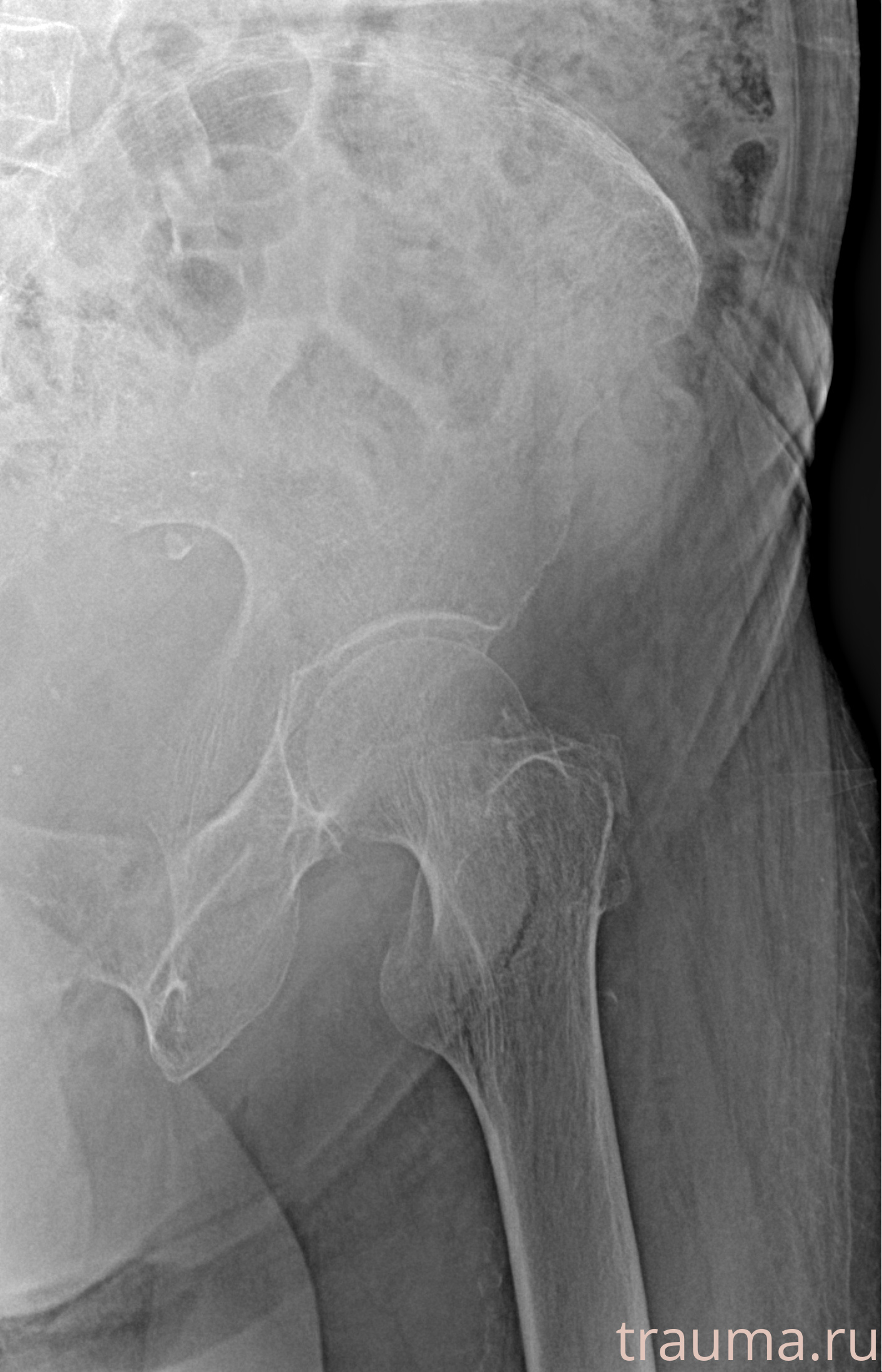 Рентген на дому: по вашему адресу приезжает врач-рентгенолог, травматолог-ортопед с мобильным рентгеновским аппаратом, проводит диагностику травмы или заболевания, делает необходимые рентгенограммы, дает рекомендации по дальнейшему лечению. Получить качественные снимки в домашних условиях возможно благодаря уникальной методике, разработанной МосРентген Центром для института  Склифосовского