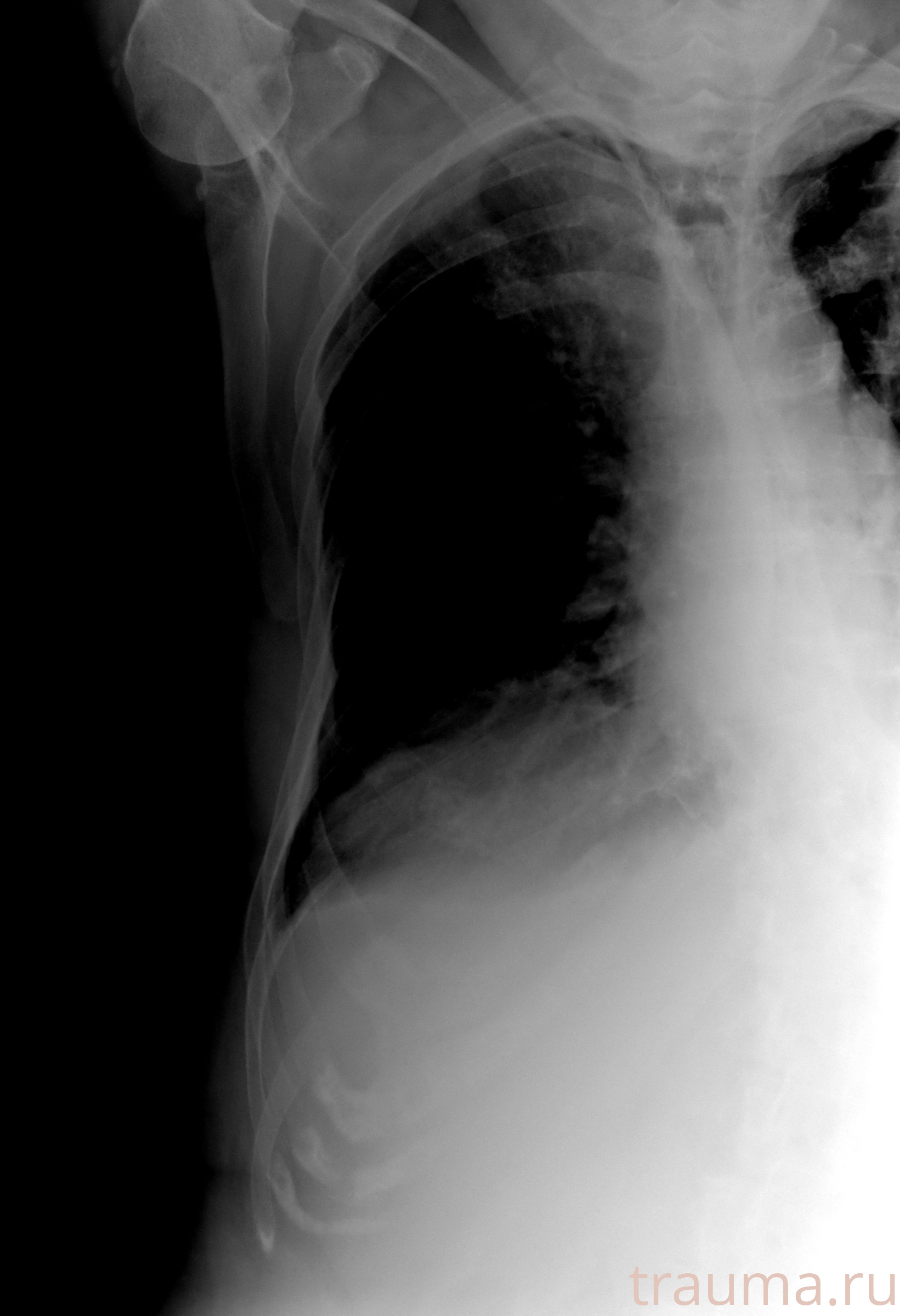 Рентген на дому: по вашему адресу приезжает врач-рентгенолог, травматолог-ортопед с мобильным рентгеновским аппаратом, проводит диагностику травмы или заболевания, делает необходимые рентгенограммы, дает рекомендации по дальнейшему лечению. Получить качественные снимки в домашних условиях возможно благодаря уникальной методике, разработанной МосРентген Центром для института  Склифосовского