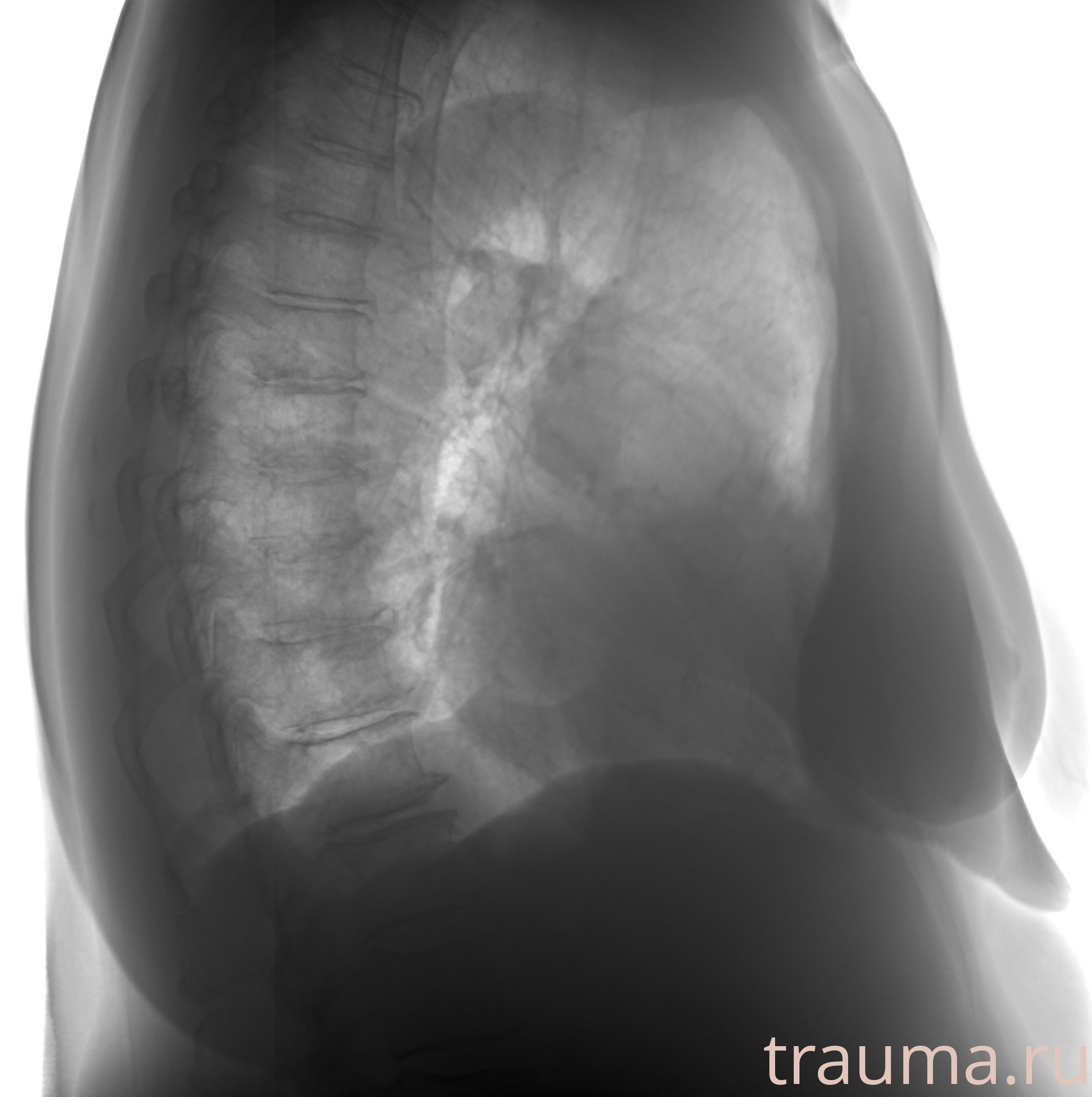 Рентген на дому: по вашему адресу приезжает врач-рентгенолог, травматолог-ортопед с мобильным рентгеновским аппаратом, проводит диагностику травмы или заболевания, делает необходимые рентгенограммы, дает рекомендации по дальнейшему лечению. Получить качественные снимки в домашних условиях возможно благодаря уникальной методике, разработанной МосРентген Центром для института  Склифосовского