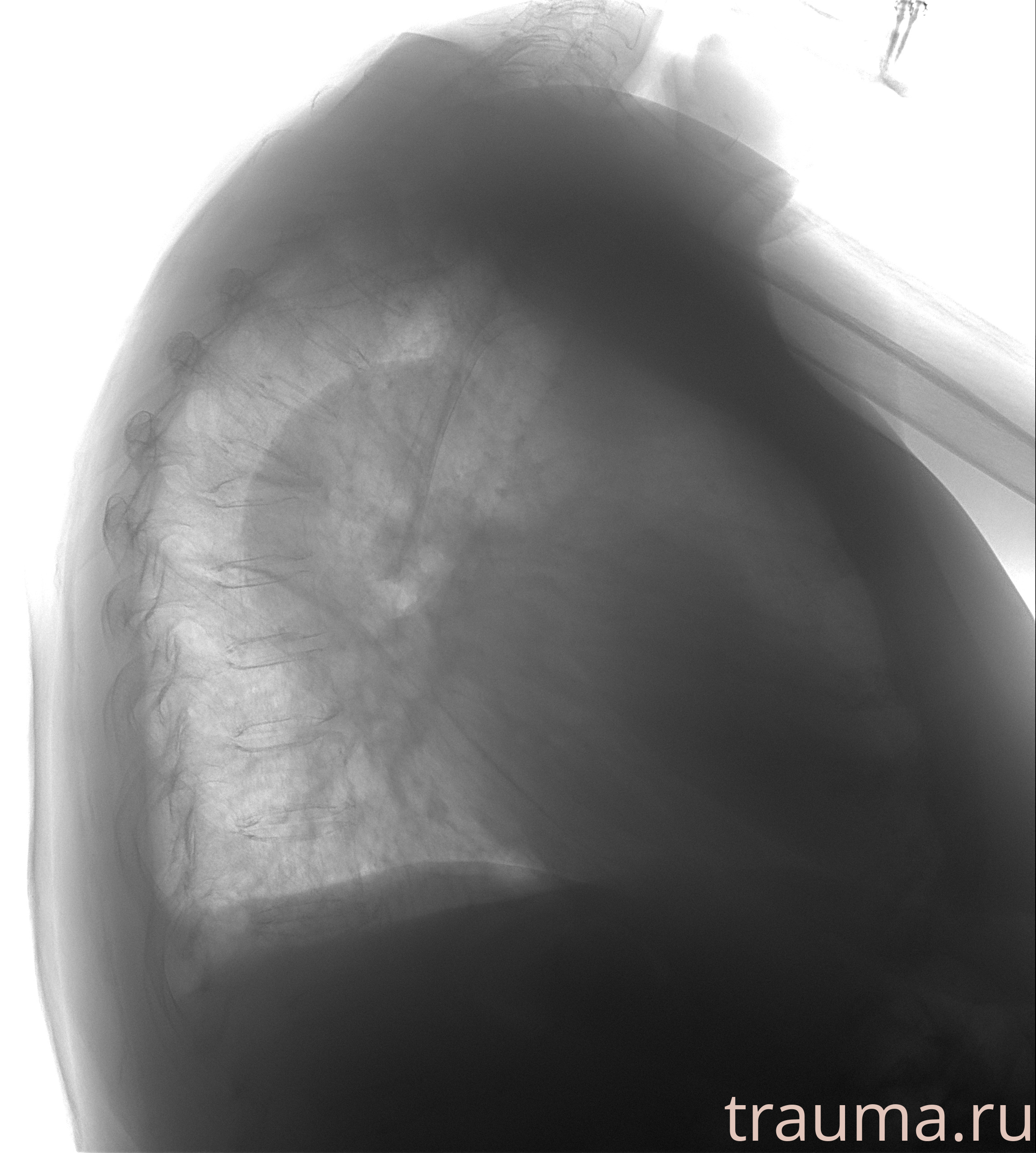 Рентген на дому: по вашему адресу приезжает врач-рентгенолог, травматолог-ортопед с мобильным рентгеновским аппаратом, проводит диагностику травмы или заболевания, делает необходимые рентгенограммы, дает рекомендации по дальнейшему лечению. Получить качественные снимки в домашних условиях возможно благодаря уникальной методике, разработанной МосРентген Центром для института  Склифосовского