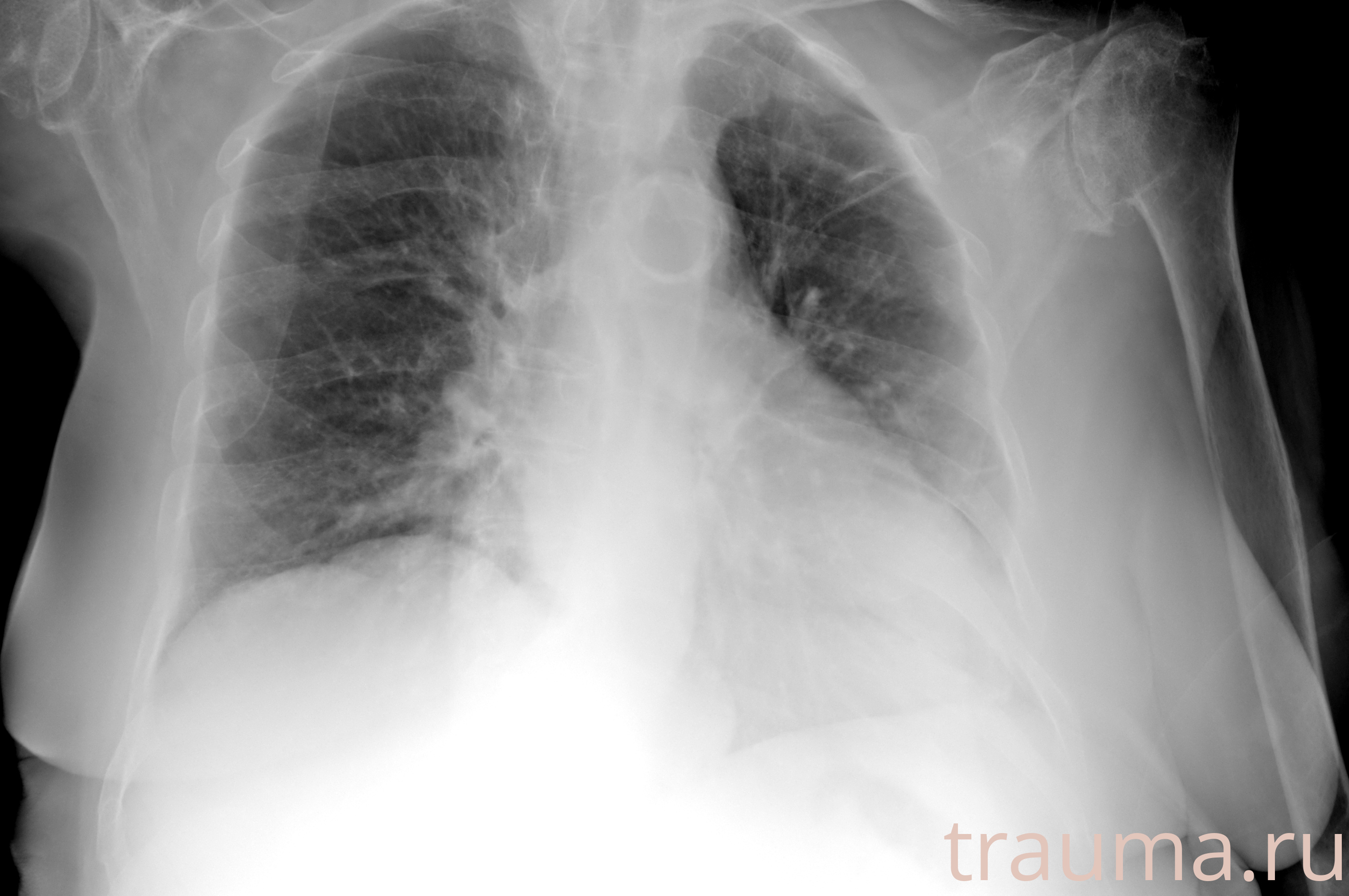 Рентген на дому: по вашему адресу приезжает врач-рентгенолог, травматолог-ортопед с мобильным рентгеновским аппаратом, проводит диагностику травмы или заболевания, делает необходимые рентгенограммы, дает рекомендации по дальнейшему лечению. Получить качественные снимки в домашних условиях возможно благодаря уникальной методике, разработанной МосРентген Центром для института  Склифосовского