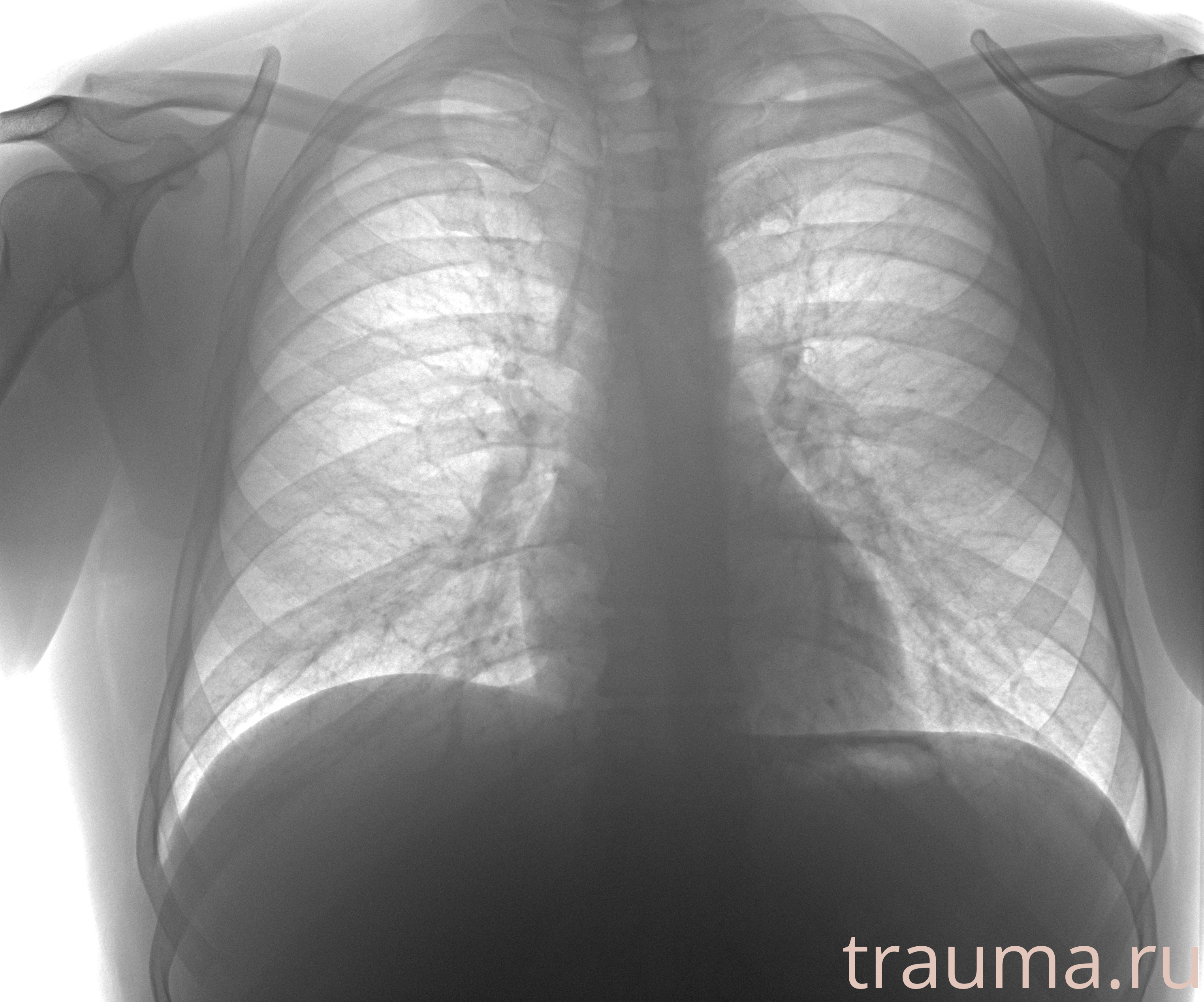 Рентген на дому: по вашему адресу приезжает врач-рентгенолог, травматолог-ортопед с мобильным рентгеновским аппаратом, проводит диагностику травмы или заболевания, делает необходимые рентгенограммы, дает рекомендации по дальнейшему лечению. Получить качественные снимки в домашних условиях возможно благодаря уникальной методике, разработанной МосРентген Центром для института  Склифосовского