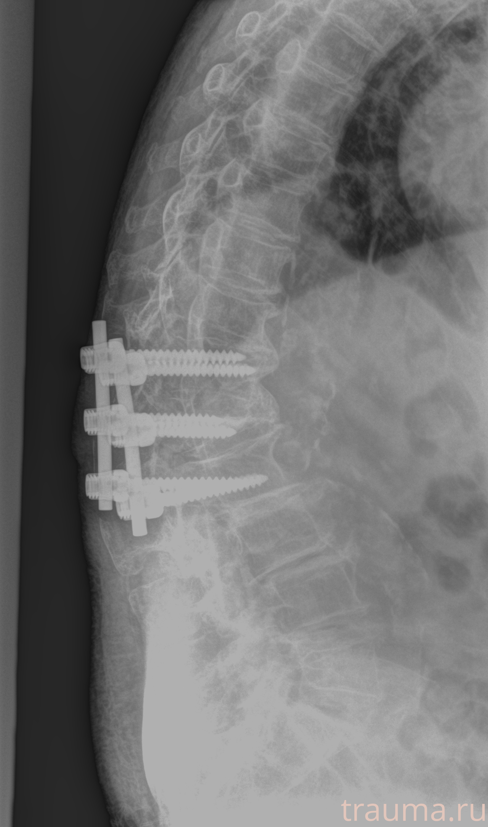 Рентген на дому: по вашему адресу приезжает врач-рентгенолог, травматолог-ортопед с мобильным рентгеновским аппаратом, проводит диагностику травмы или заболевания, делает необходимые рентгенограммы, дает рекомендации по дальнейшему лечению. Получить качественные снимки в домашних условиях возможно благодаря уникальной методике, разработанной МосРентген Центром для института  Склифосовского