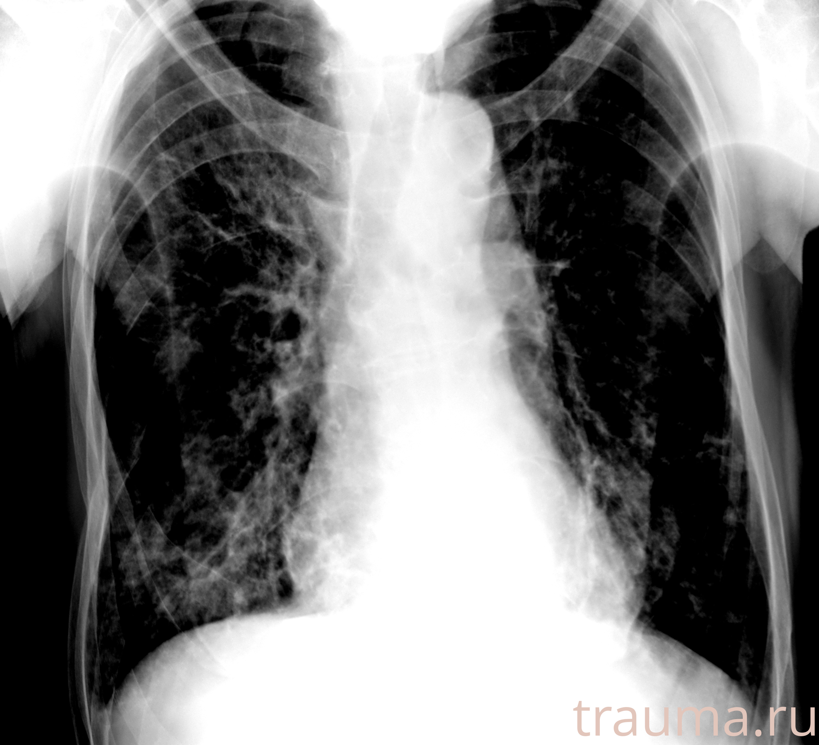 Рентген на дому: по вашему адресу приезжает врач-рентгенолог, травматолог-ортопед с мобильным рентгеновским аппаратом, проводит диагностику травмы или заболевания, делает необходимые рентгенограммы, дает рекомендации по дальнейшему лечению. Получить качественные снимки в домашних условиях возможно благодаря уникальной методике, разработанной МосРентген Центром для института  Склифосовского