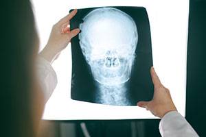 Рентгенологические укладки височной кости